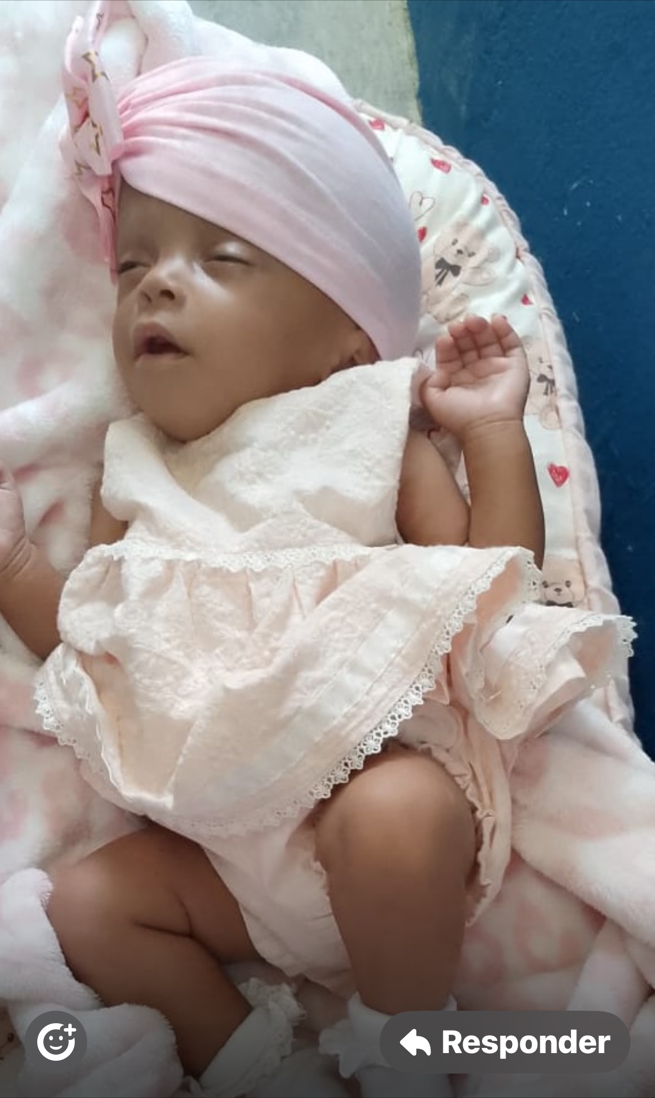 Cirugía urgente para bebé de 4 meses campaign photo, 4 of 5