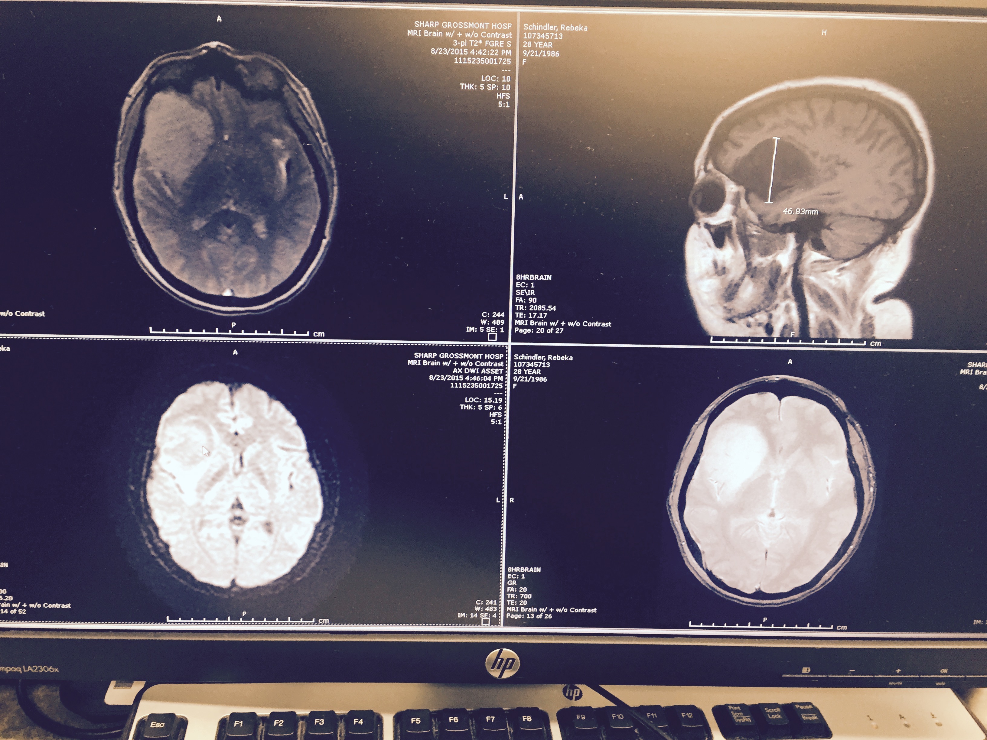 Donate for Rebeka Schindler's Healing Journey campaign photo, 4 of 5