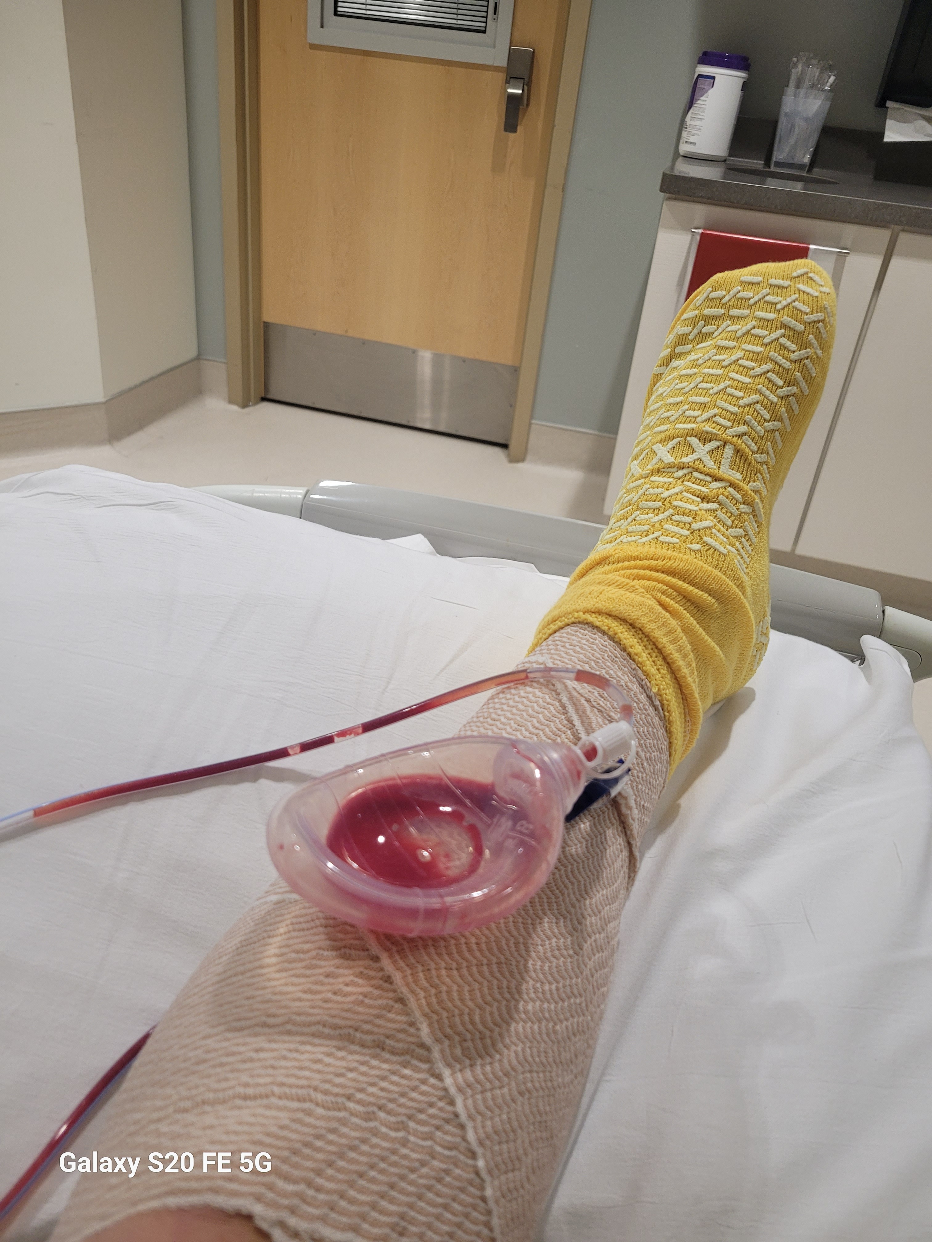 Assist in Final Steps of Cancer Recovery campaign photo, 6 of 7