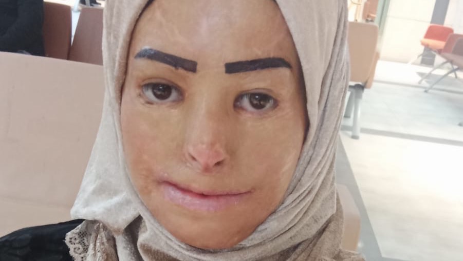 Donate to Transform Hedaya's Life campaign photo, 5 of 6