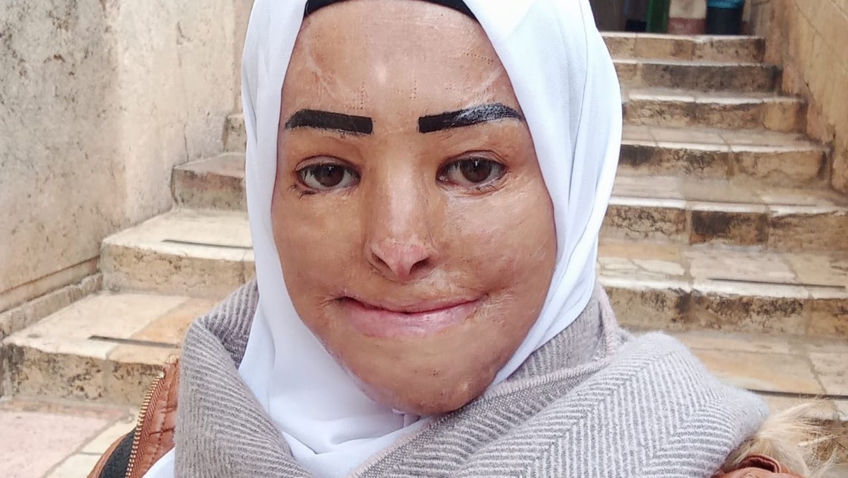Donate to Transform Hedaya's Life campaign photo, 4 of 6