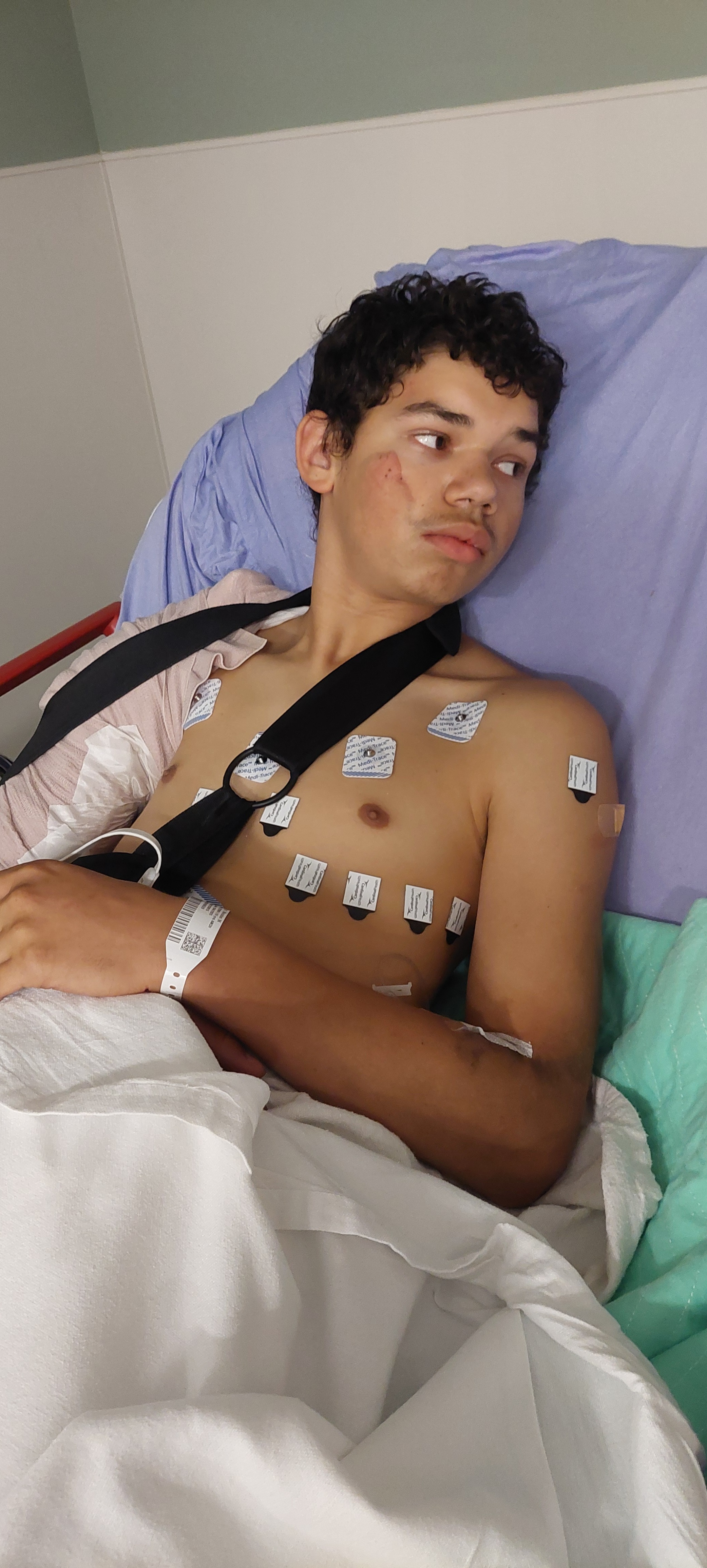 Support malakai recovery after being hit by a car on his bik campaign photo, 6 of 7