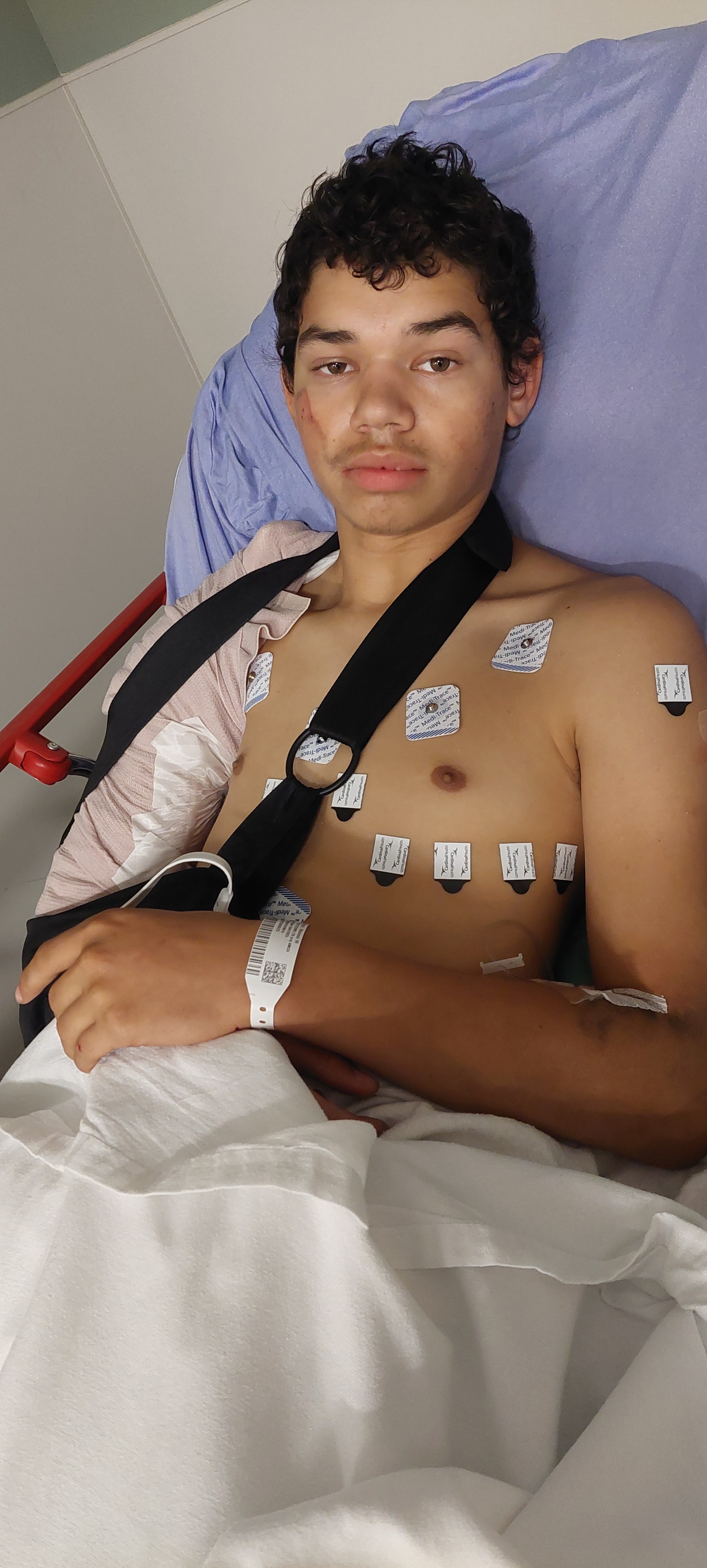 Support malakai recovery after being hit by a car on his bik campaign photo, 2 of 7
