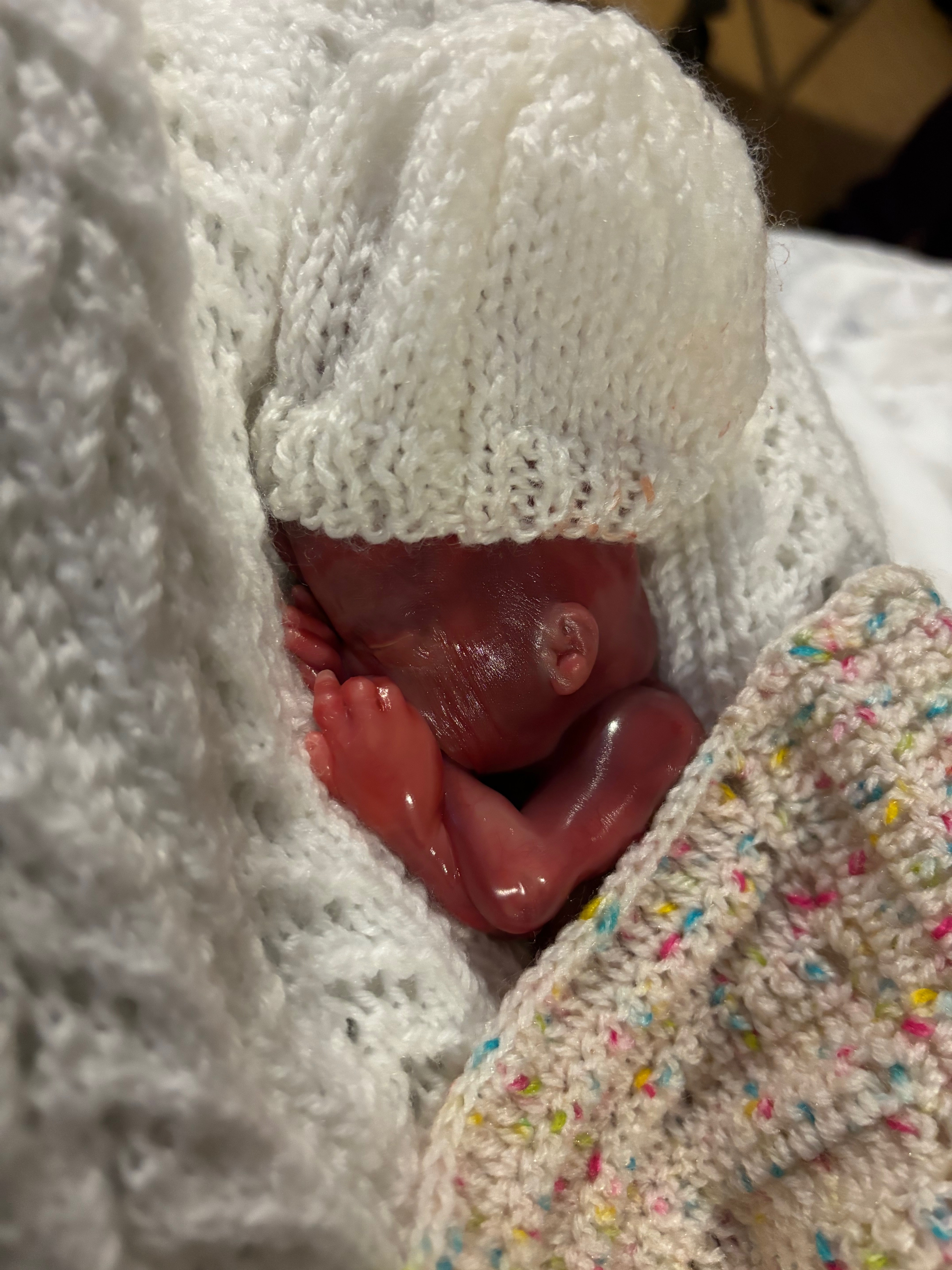 Miracle IVF campaign photo, 5 of 6