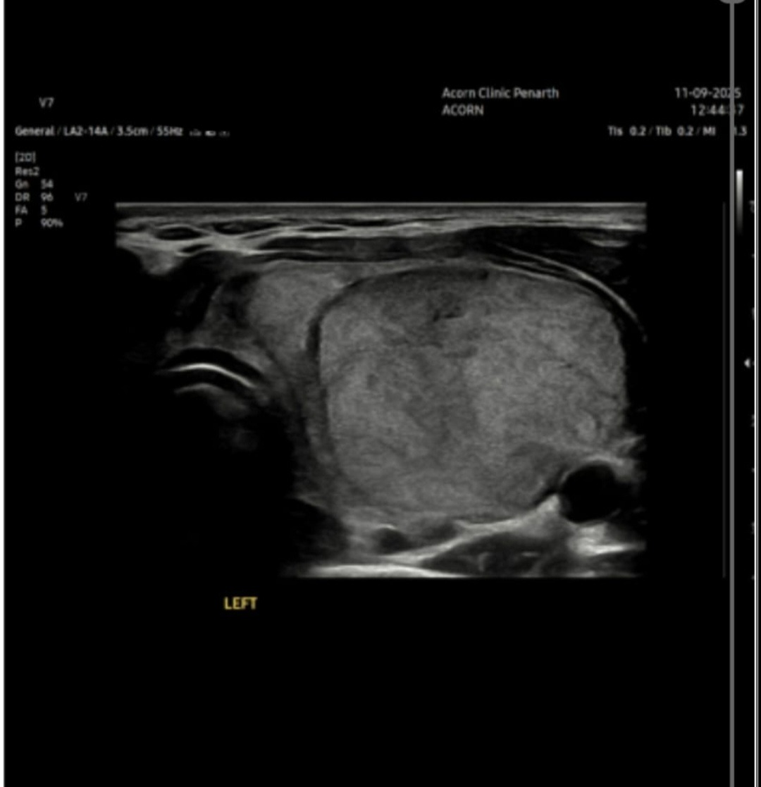 A single mother of four children with move and surgery costs campaign photo, 7 of 8