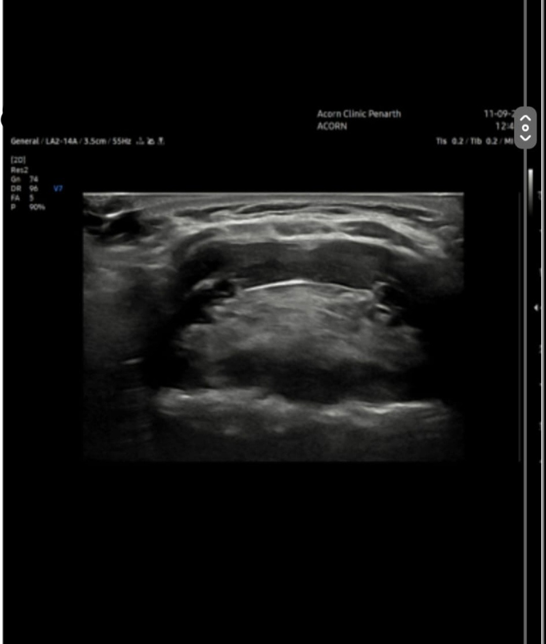 A single mother of four children with move and surgery costs campaign photo, 5 of 8