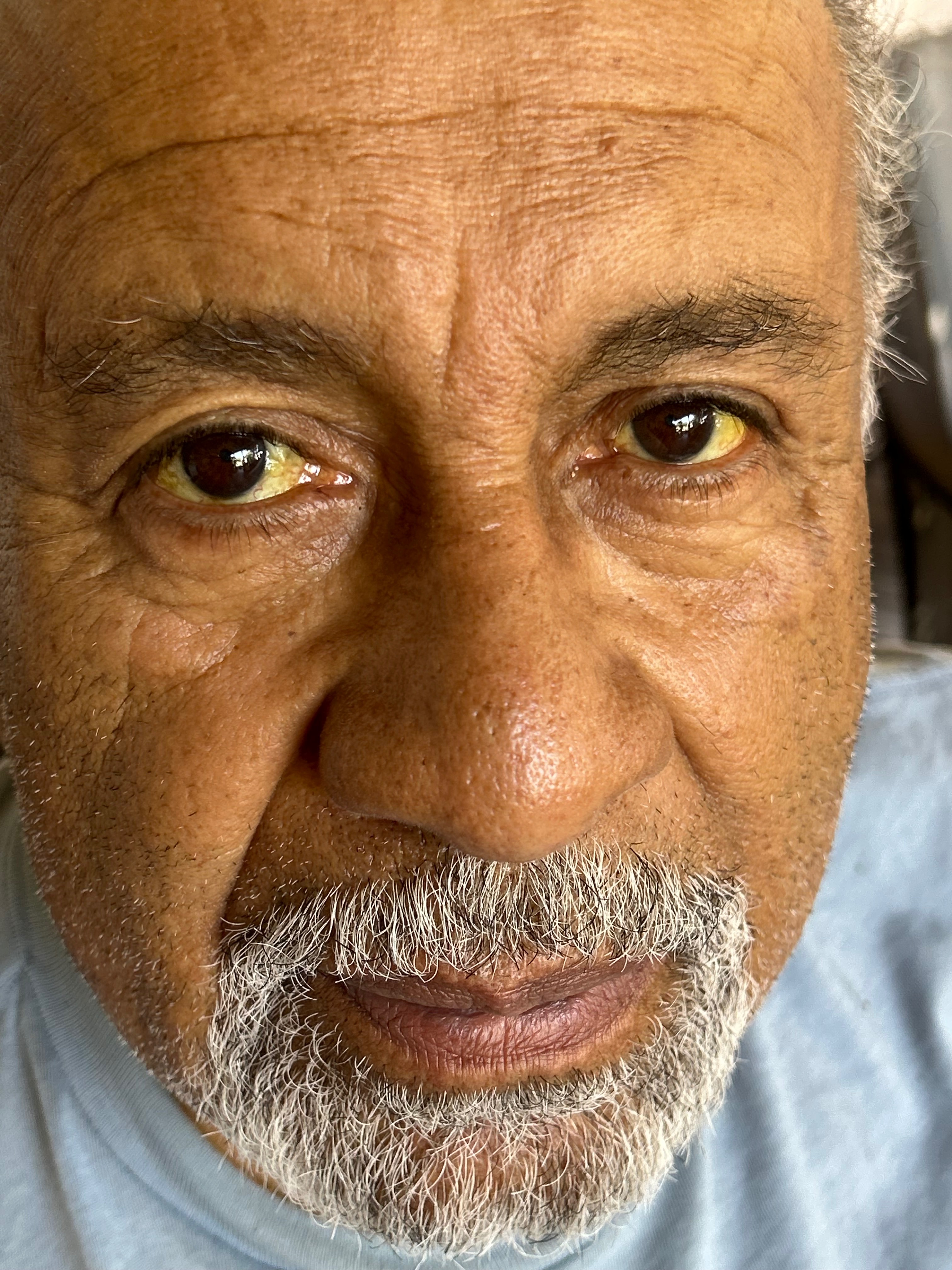 Support Fernando Rodriguez's Medical Journey campaign photo, 2 of 4