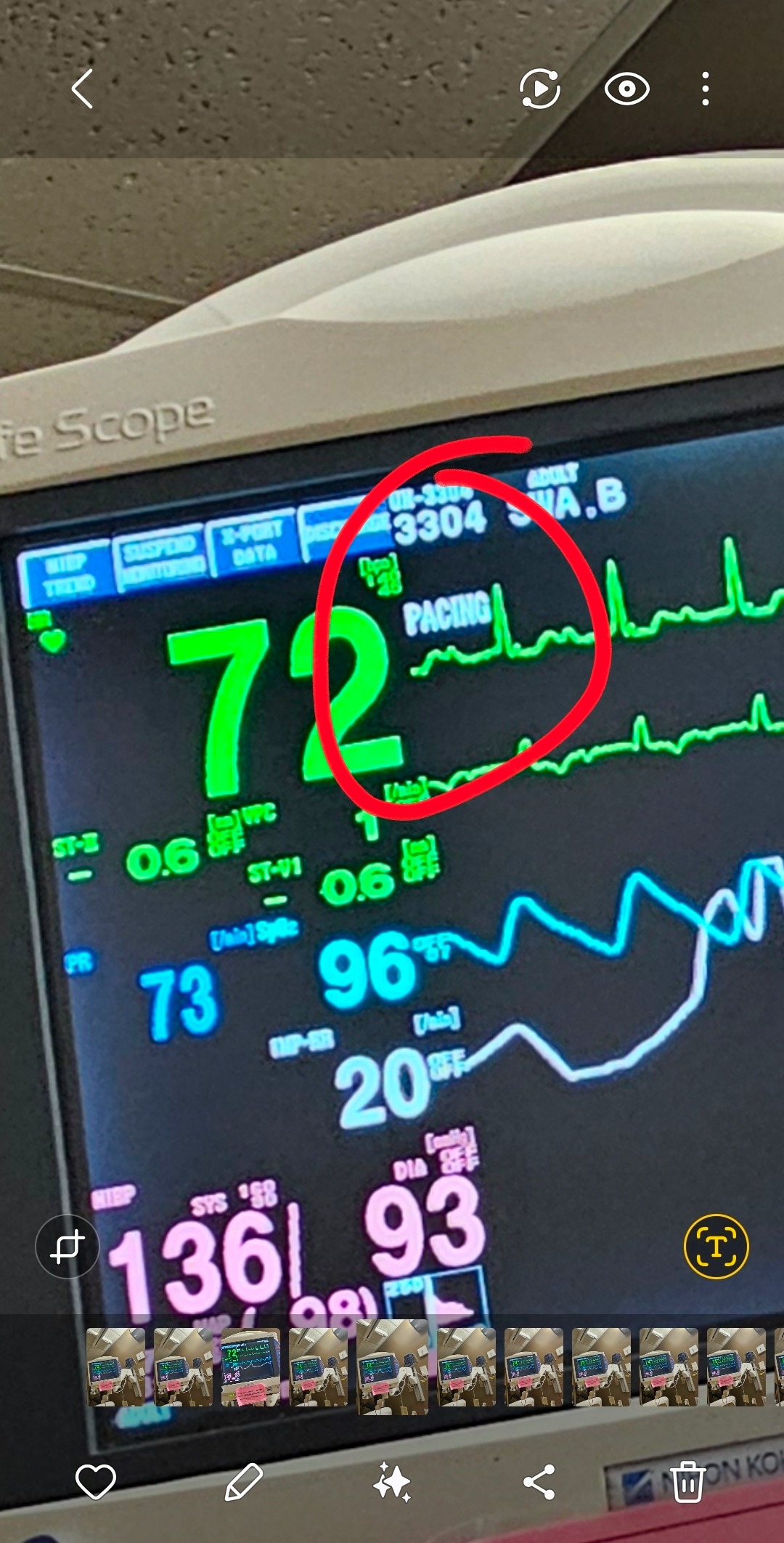 Diagnosis: Cardiac Sarcoidosis, we still need a little help. campaign photo, 2 of 8