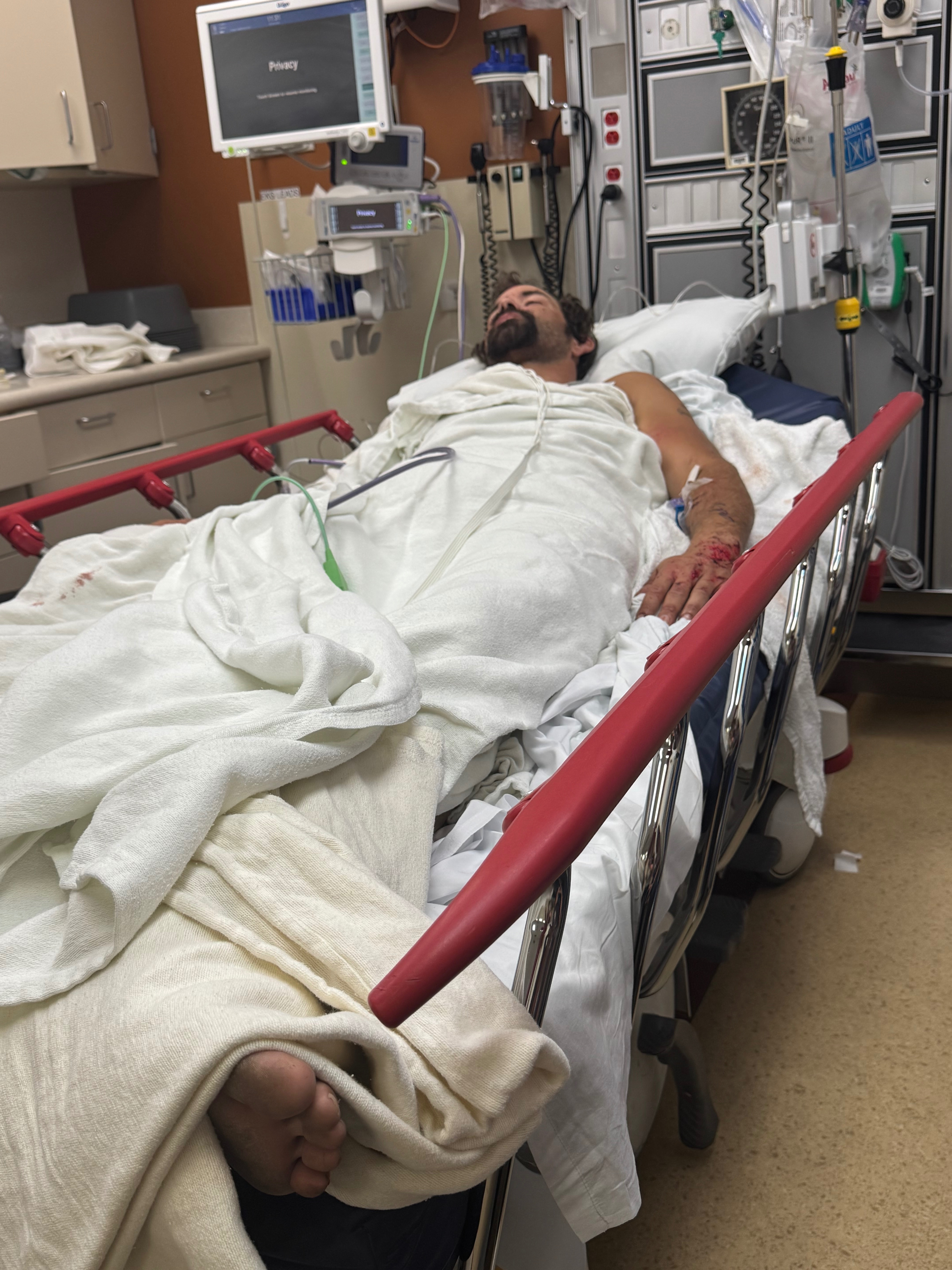 Help Ashton Heal from Severe Accident campaign photo, 2 of 4