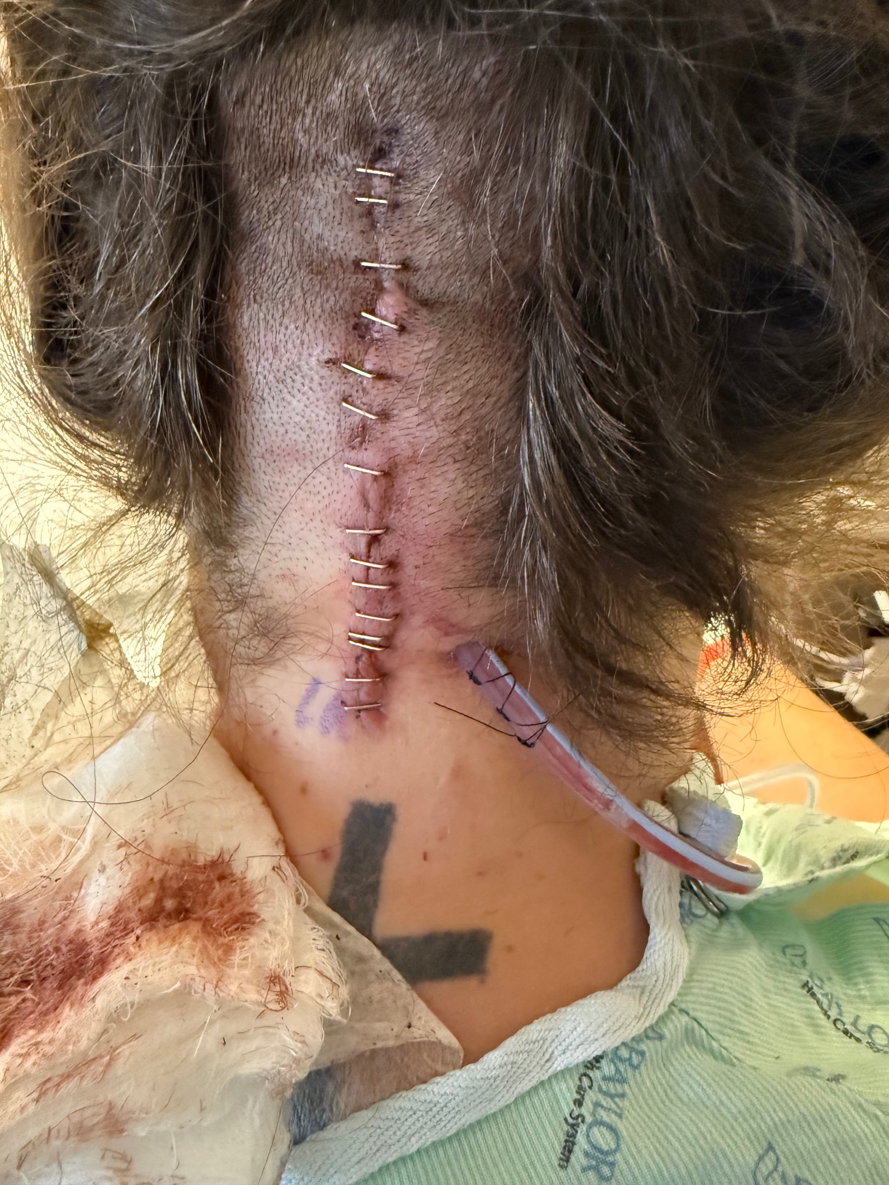 Help Ashleigh Heal After Brain Surgery & Infection Recovery campaign photo, 2 of 4
