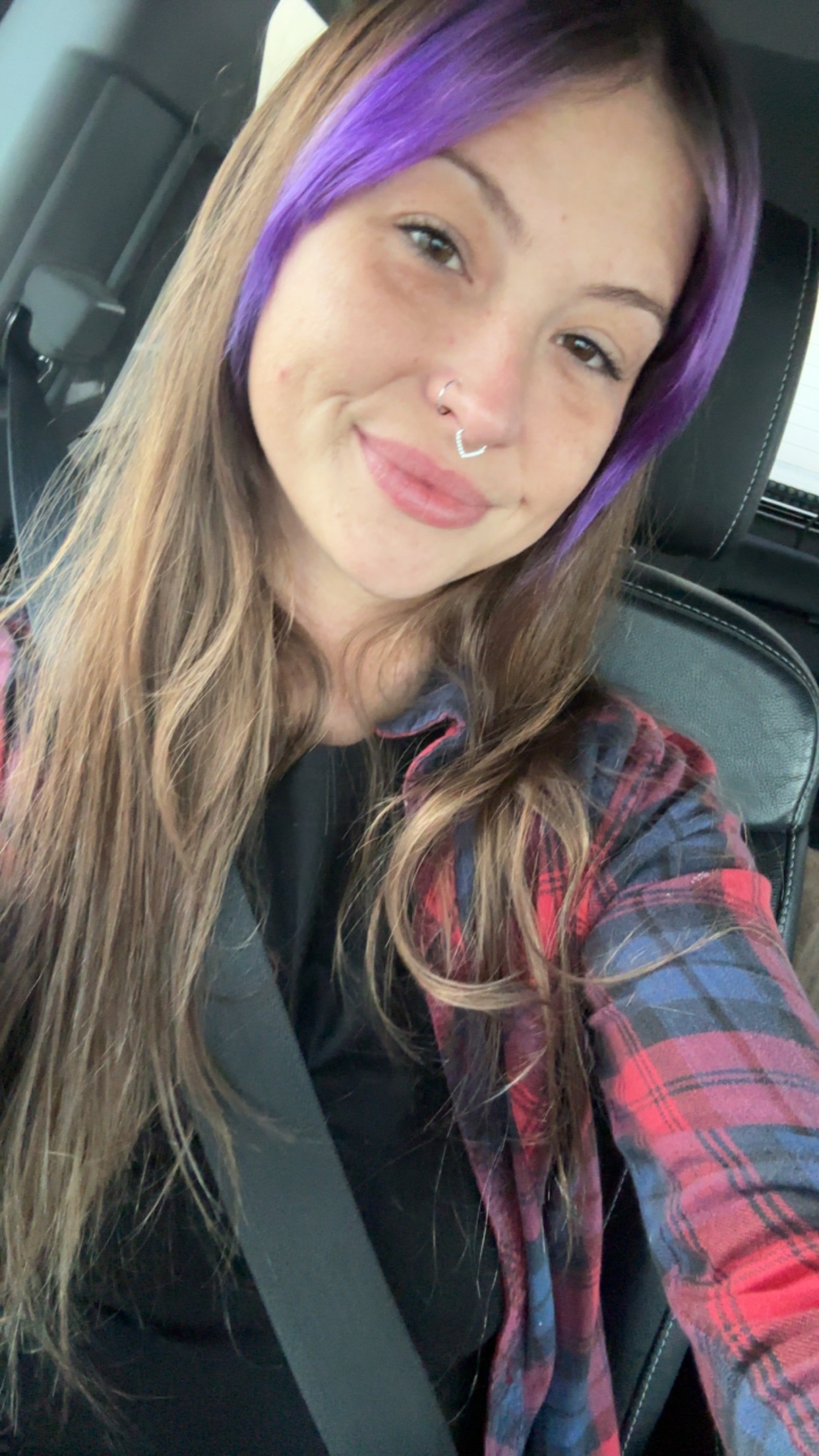 Allie Cooley's "freak accident" campaign photo, 2 of 7