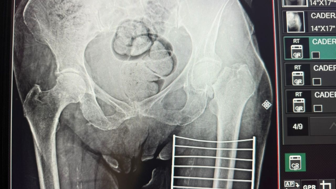 Support Urgent Surgery for Rodriguez Family's Grandmother campaign photo, 4 of 5