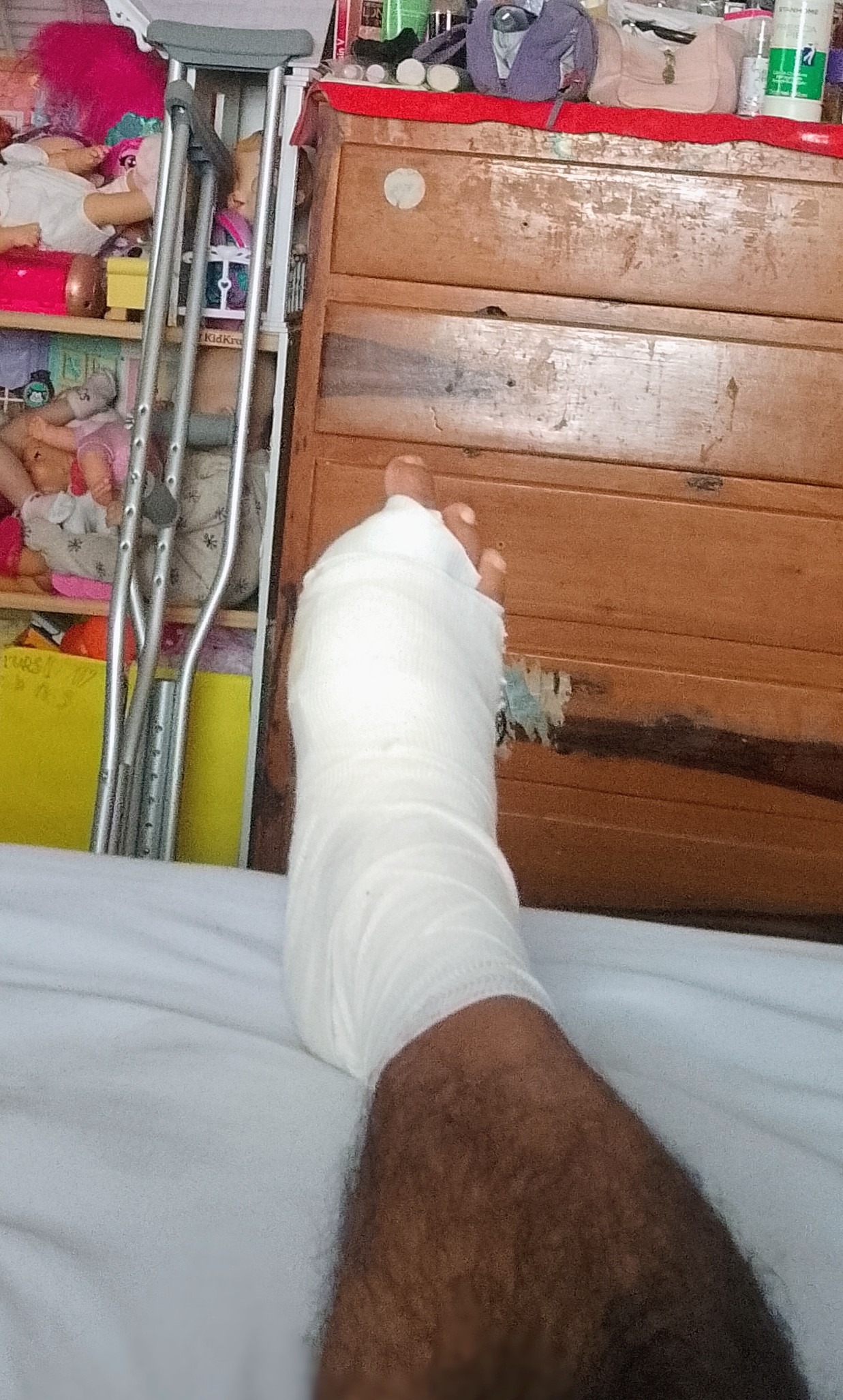 Soy diabetico y me a afectado mucho en los pies campaign photo, 2 of 5