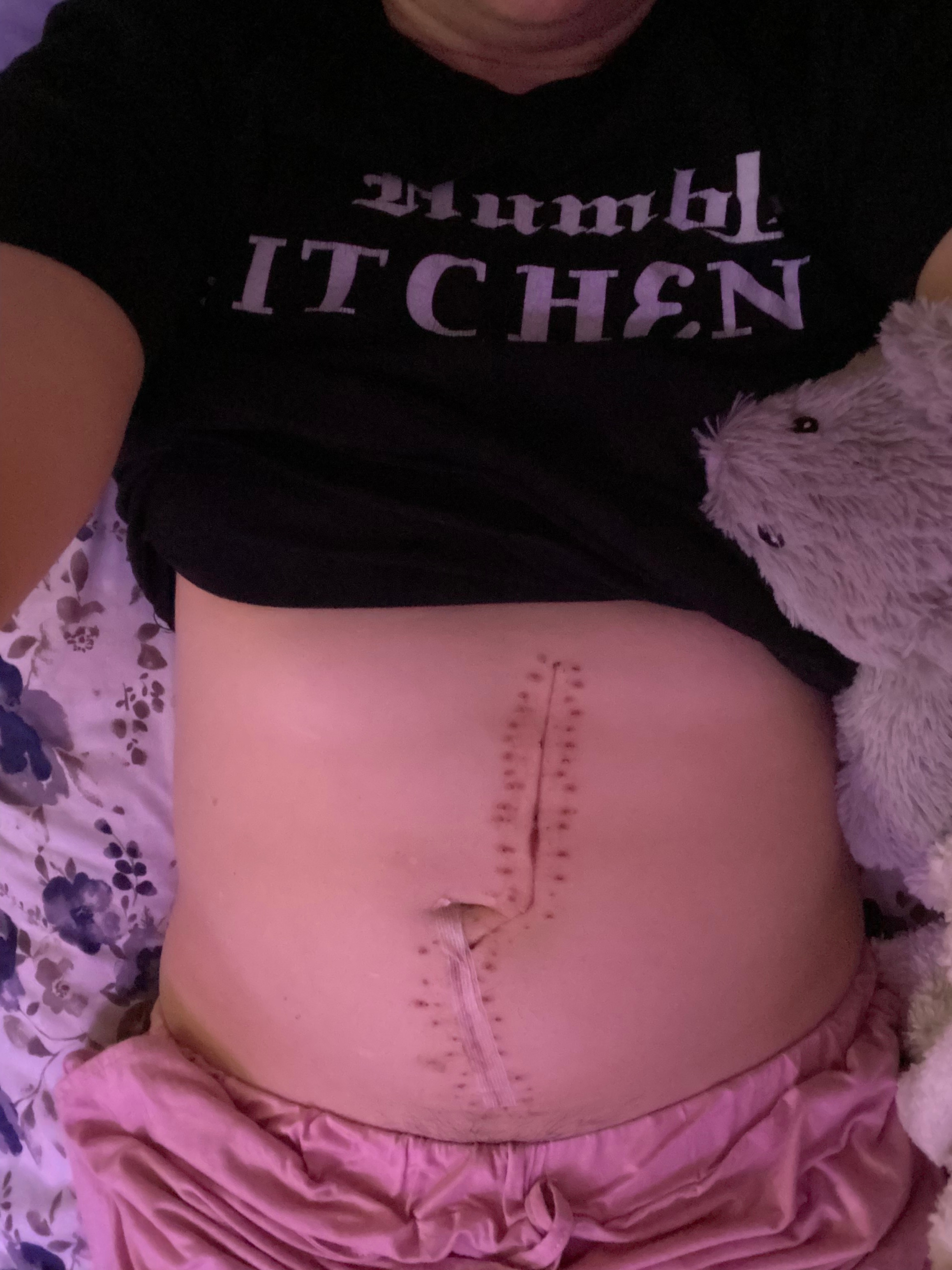 Help Jackie heal after her stage 4 cancer surgery campaign photo, 4 of 5