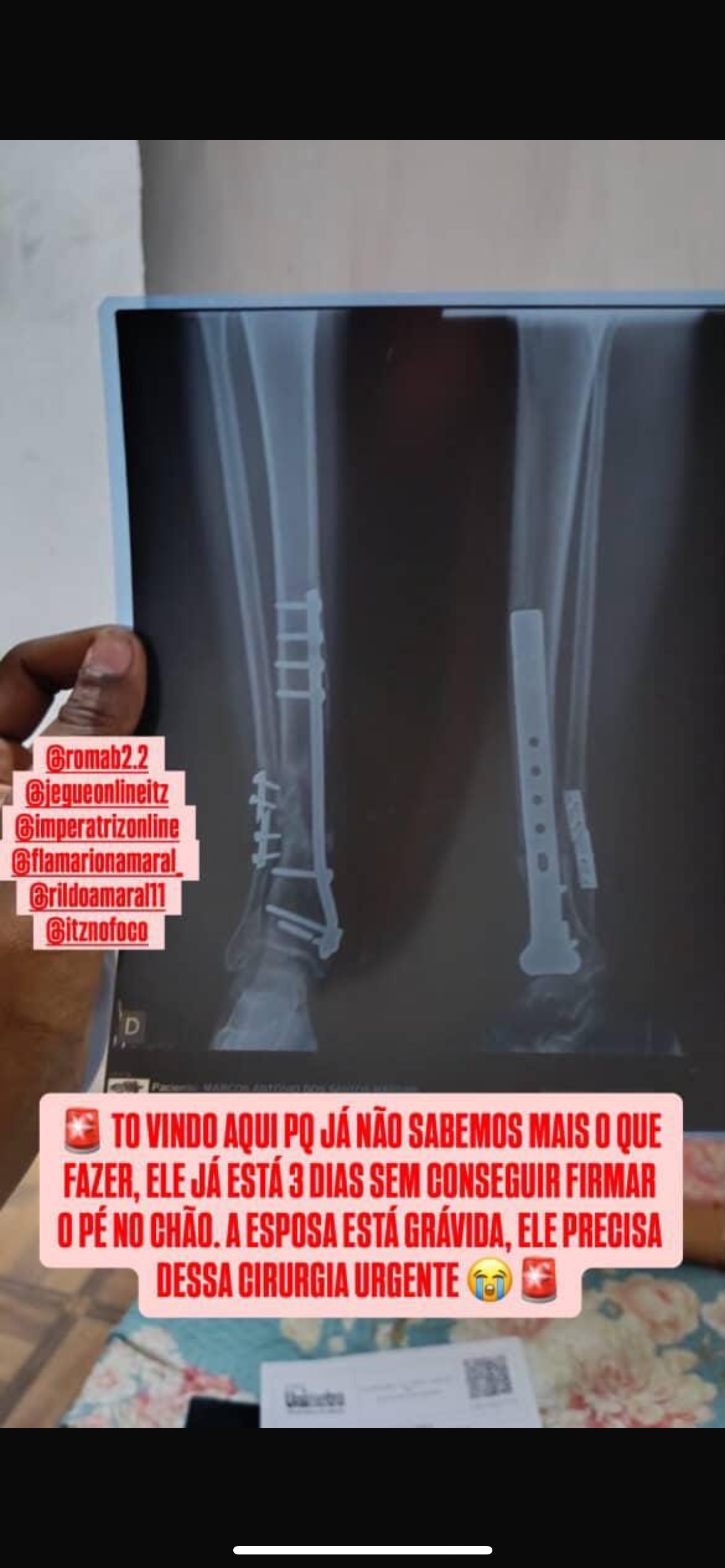 Help Marcos Walk Again: Urgent Surgery Needed campaign photo, 5 of 6