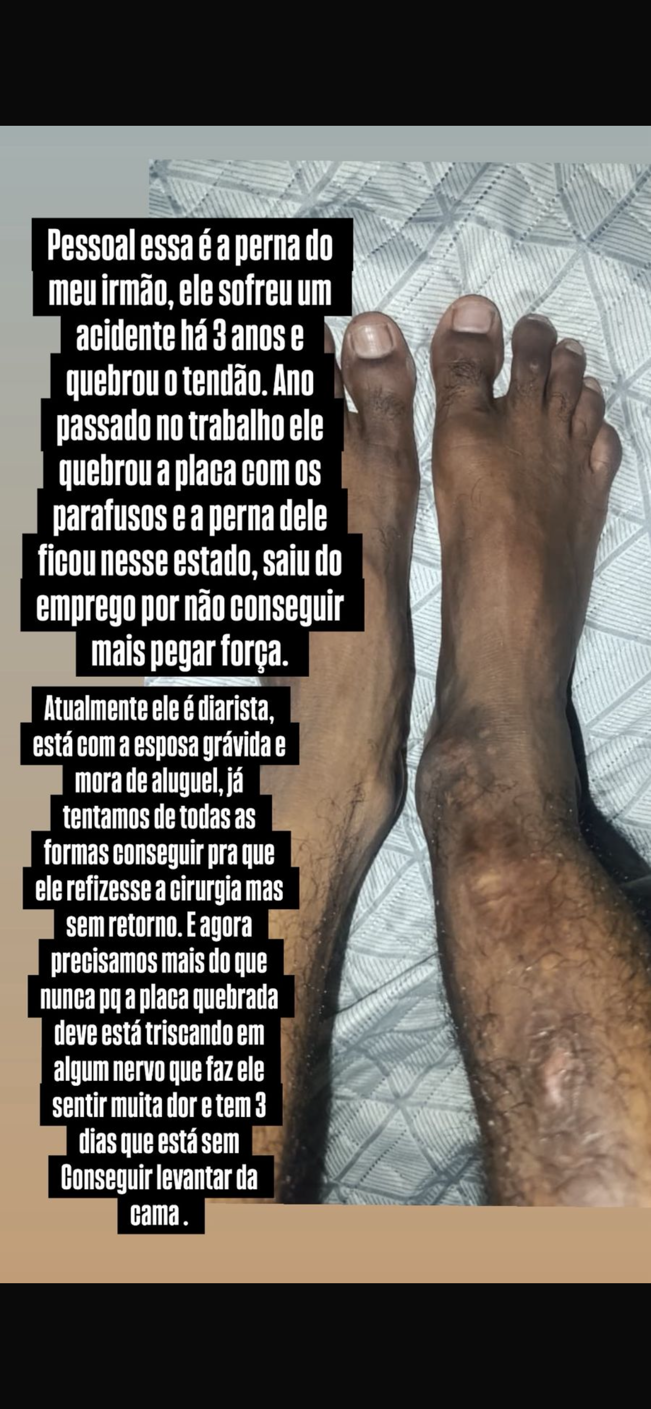 Help Marcos Walk Again: Urgent Surgery Needed campaign photo, 2 of 6