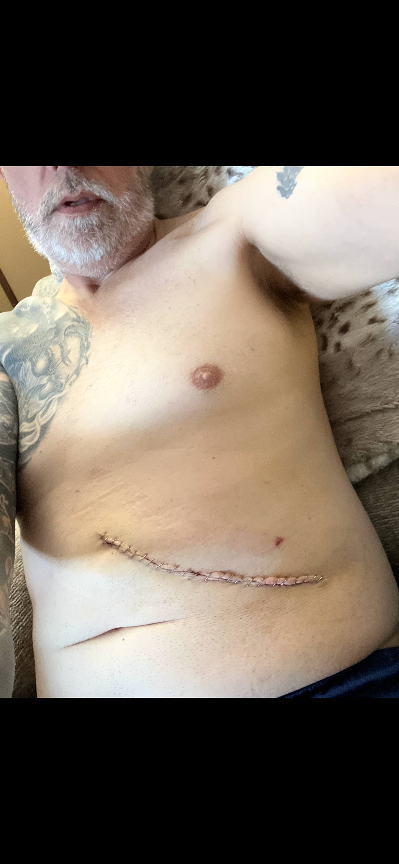 Help support Scott Noel Fight Stage 4 Cancer campaign photo, 2 of 6