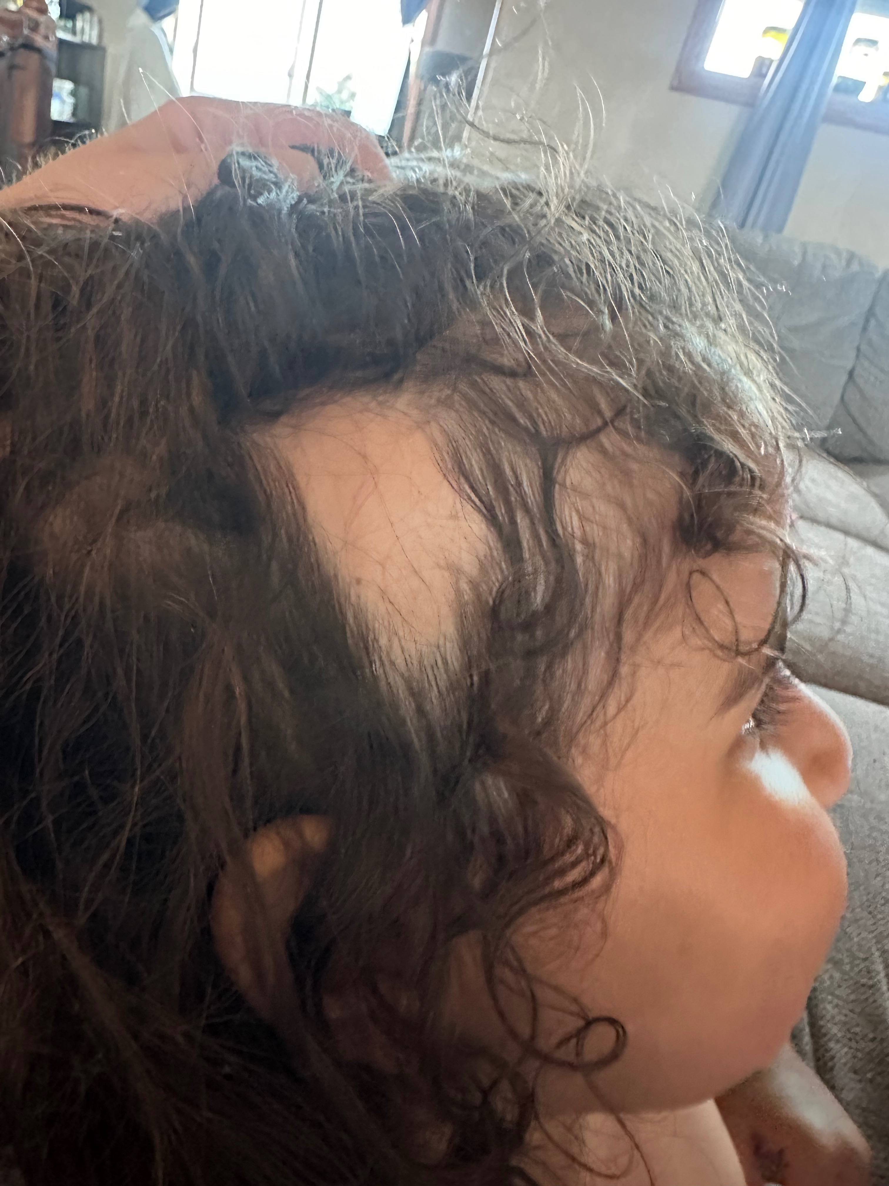 Help support Gianna’s journey with Alopecia Areata campaign photo, 2 of 7