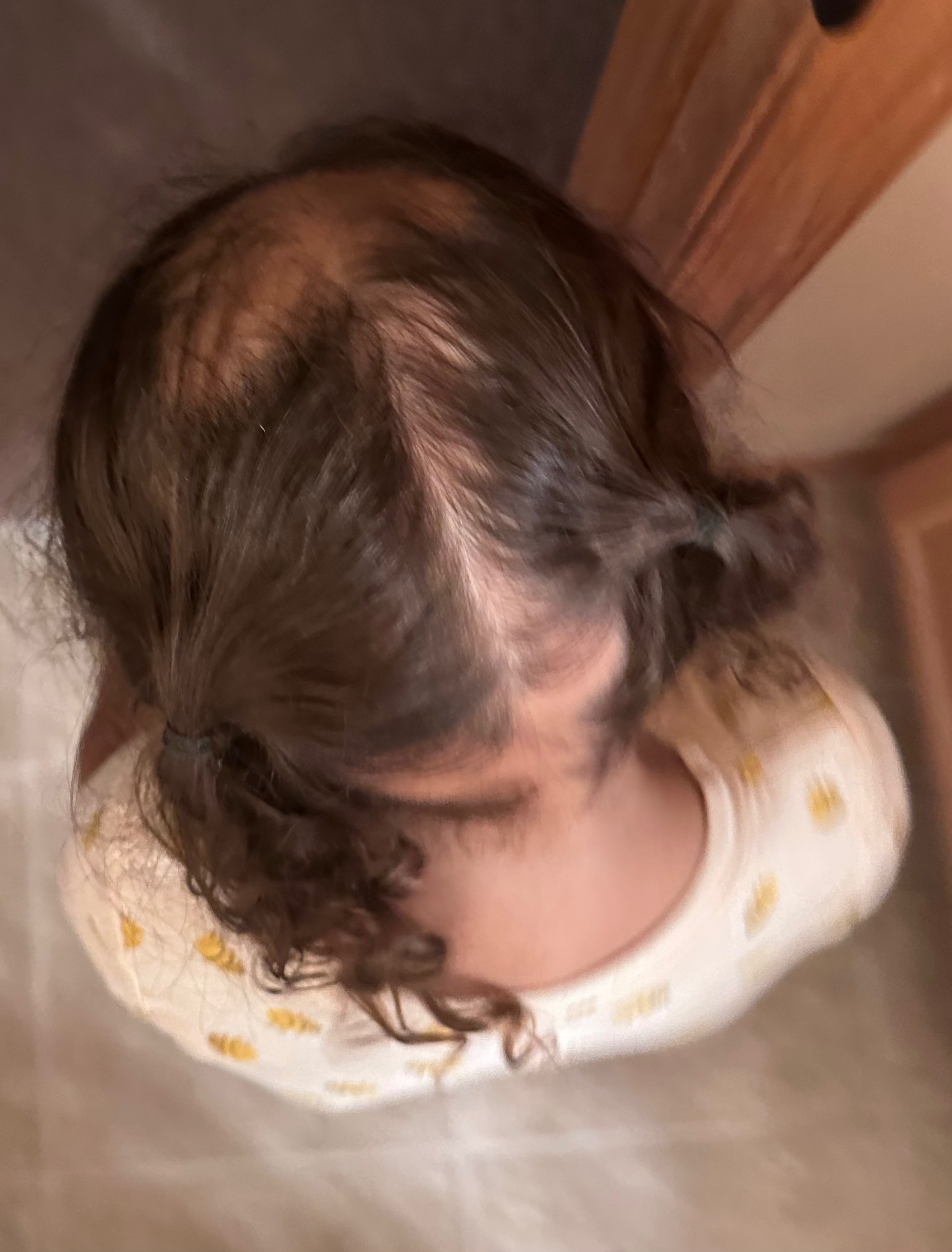 Help support Gianna’s journey with Alopecia Areata campaign photo, 4 of 7