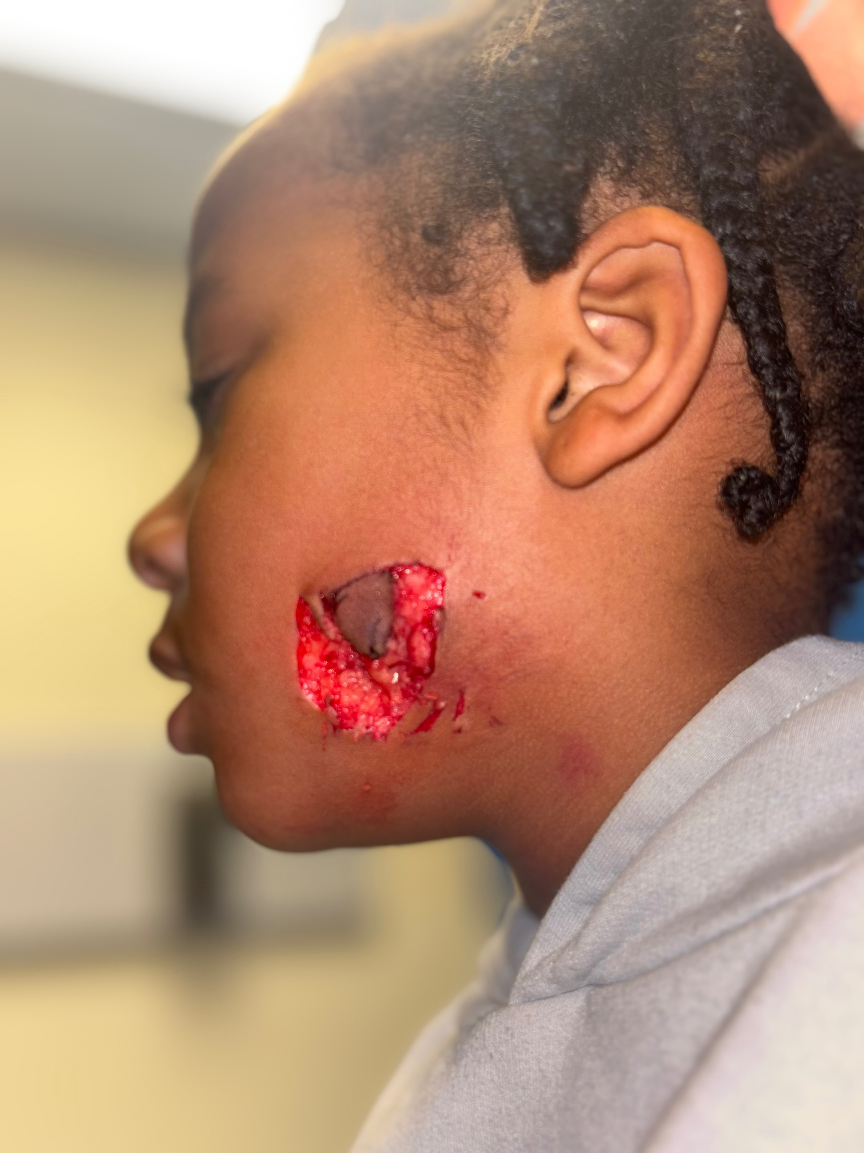Help My Son Get Justice After Dog Attack” campaign photo, 2 of 4