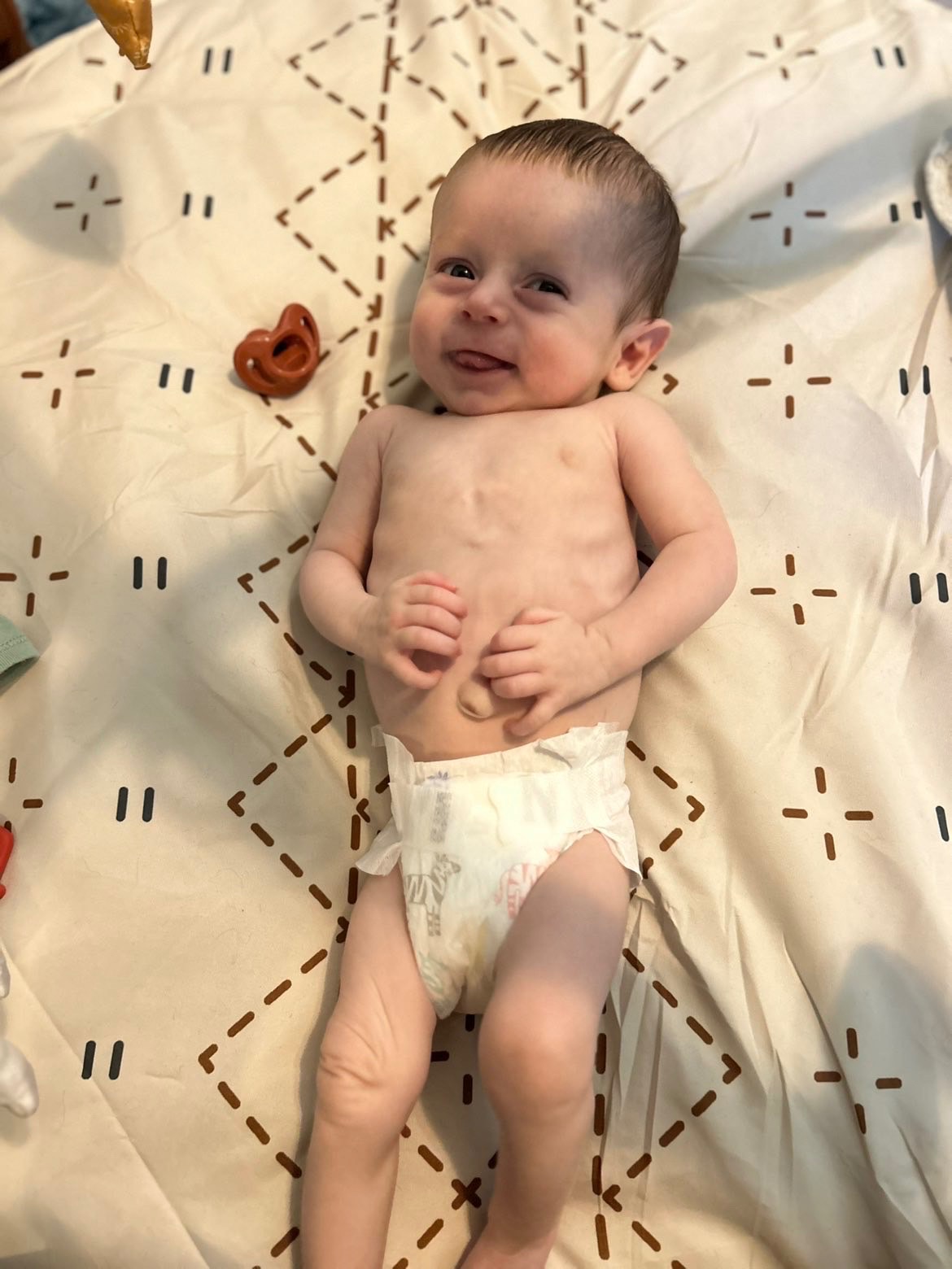 Help Baby Westin Heal His Heart campaign photo, 4 of 8