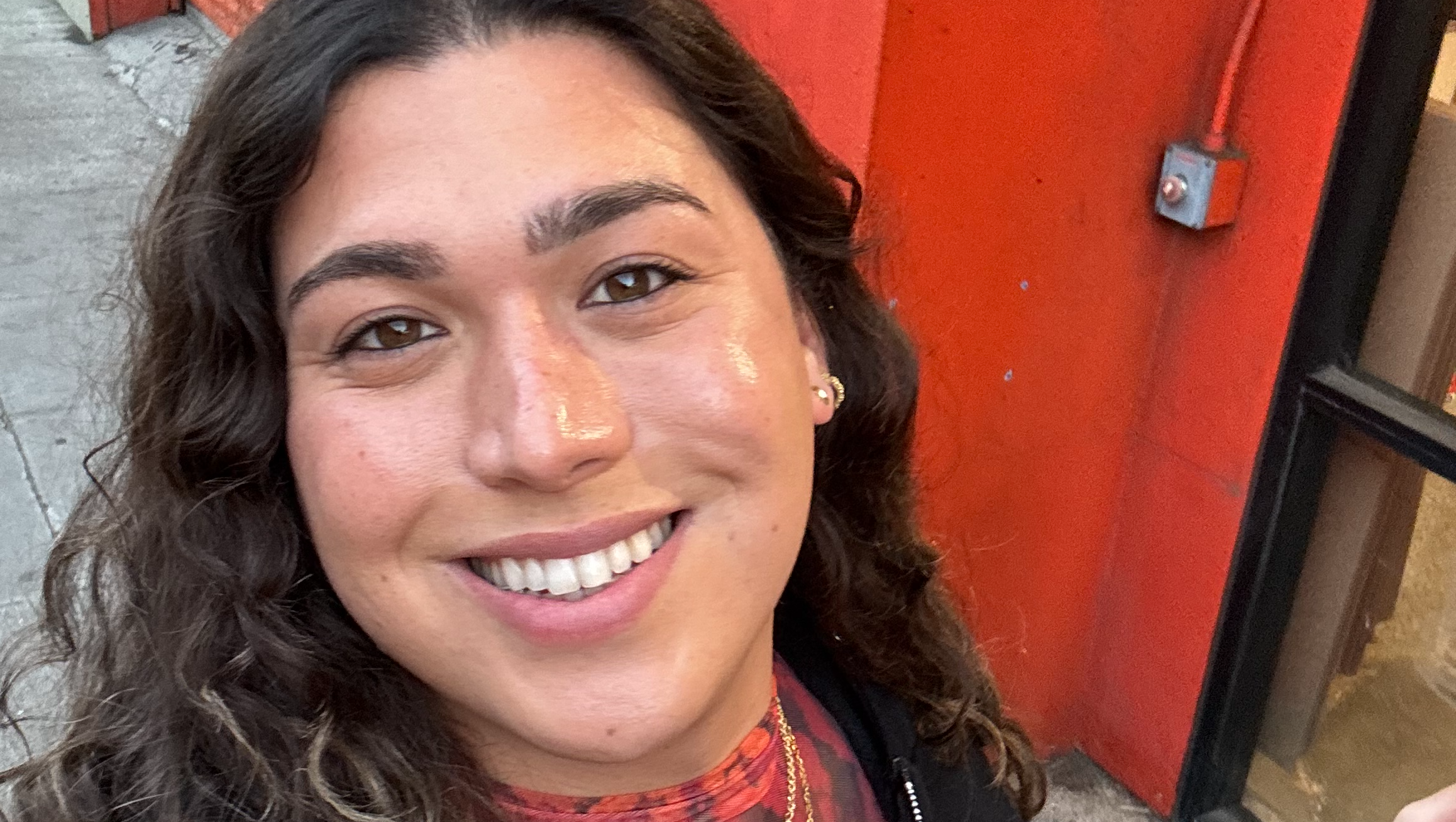 cherry's gender-affirming ffs