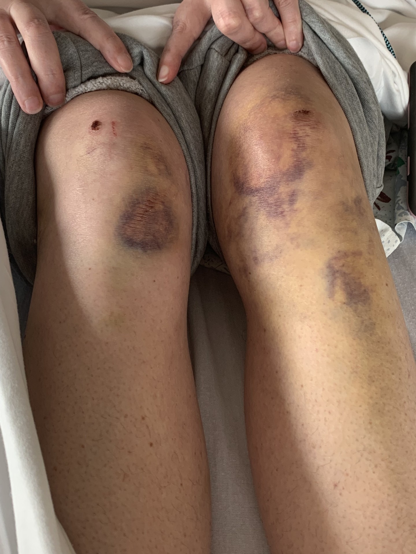 Please help Jessica & family to overcome her health battles. campaign photo, 7 of 8