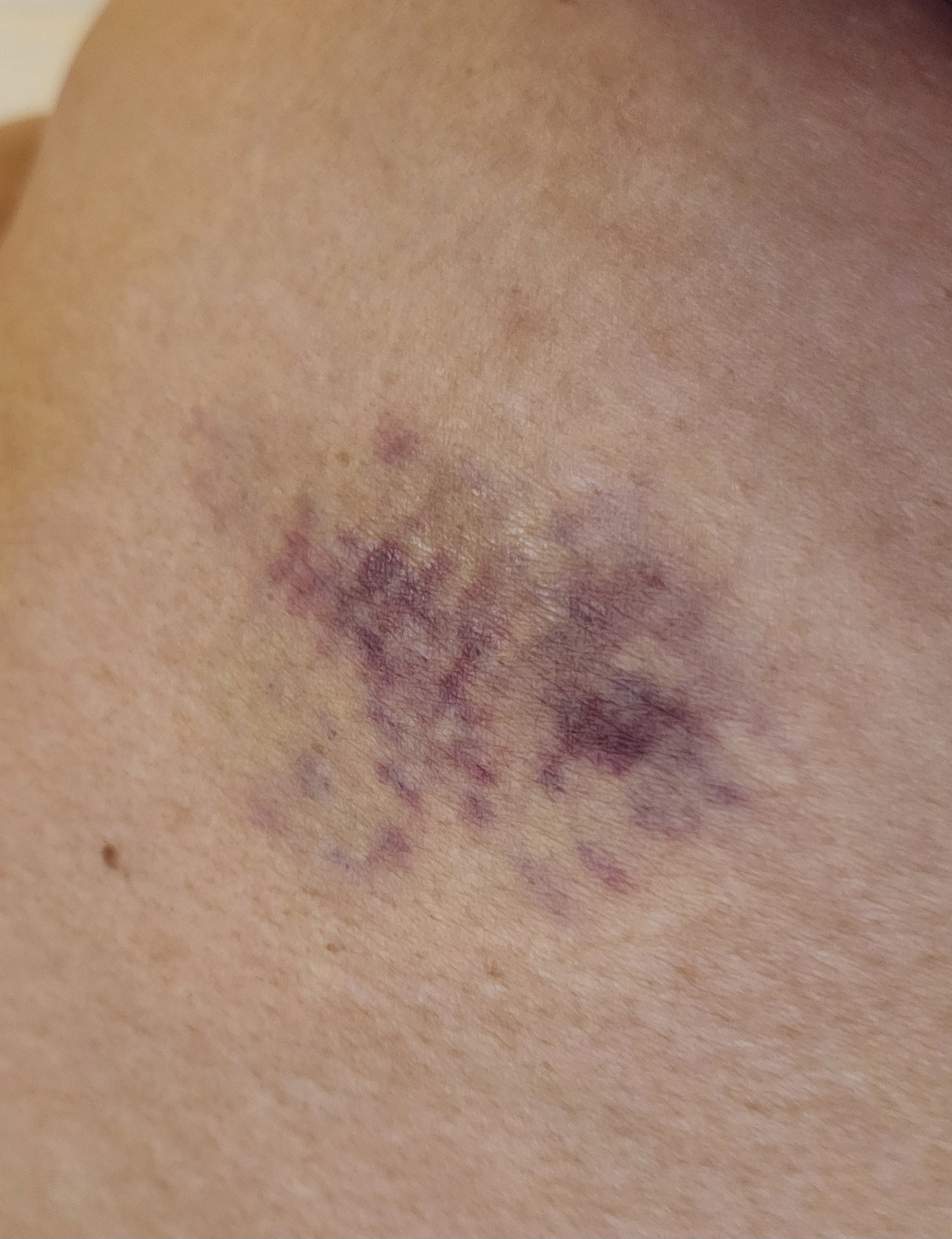 Hit-and-Run Victim in Need of Help for Recovery and Repairs campaign photo, 5 of 6