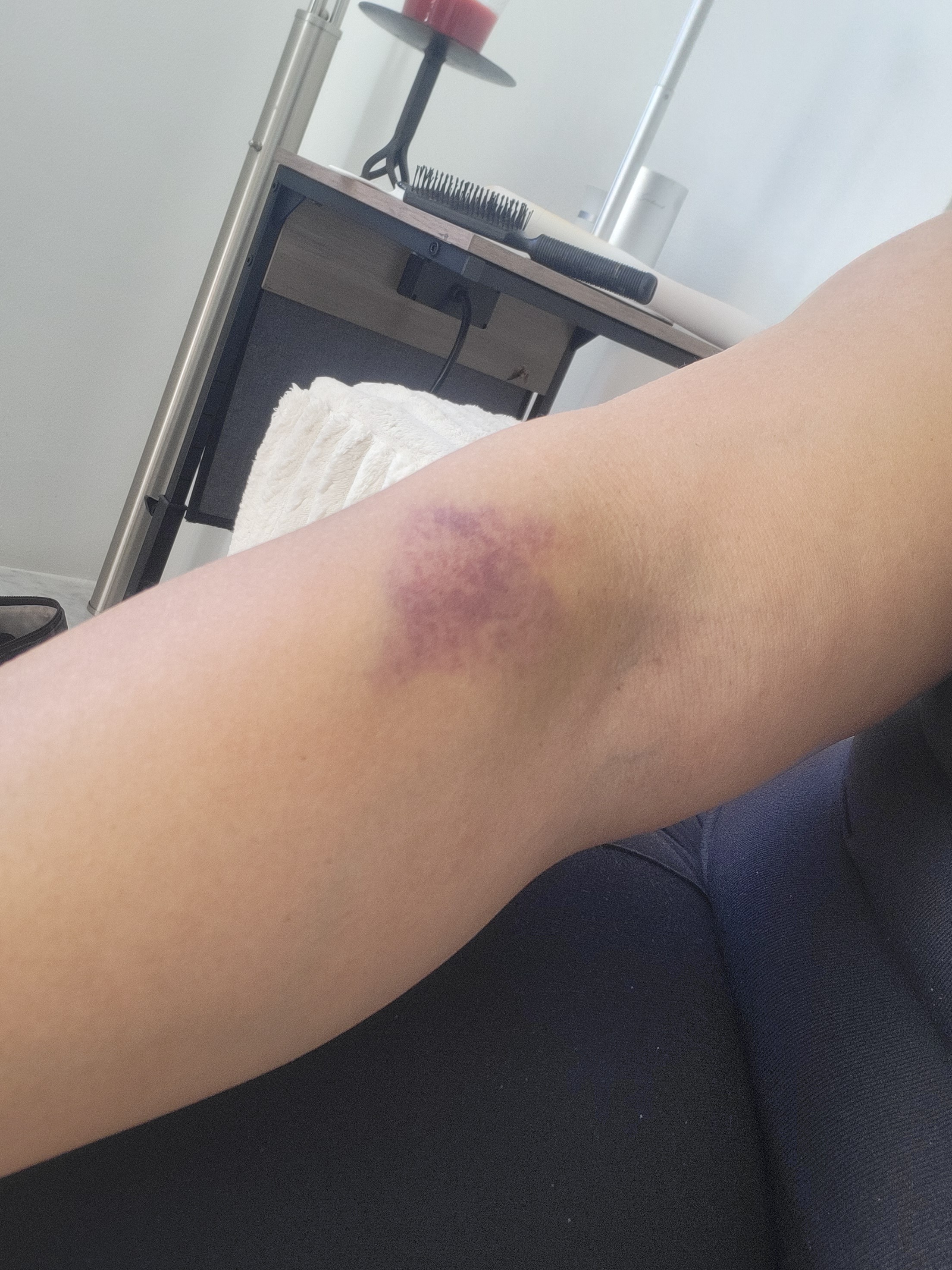 Hit-and-Run Victim in Need of Help for Recovery and Repairs campaign photo, 2 of 6