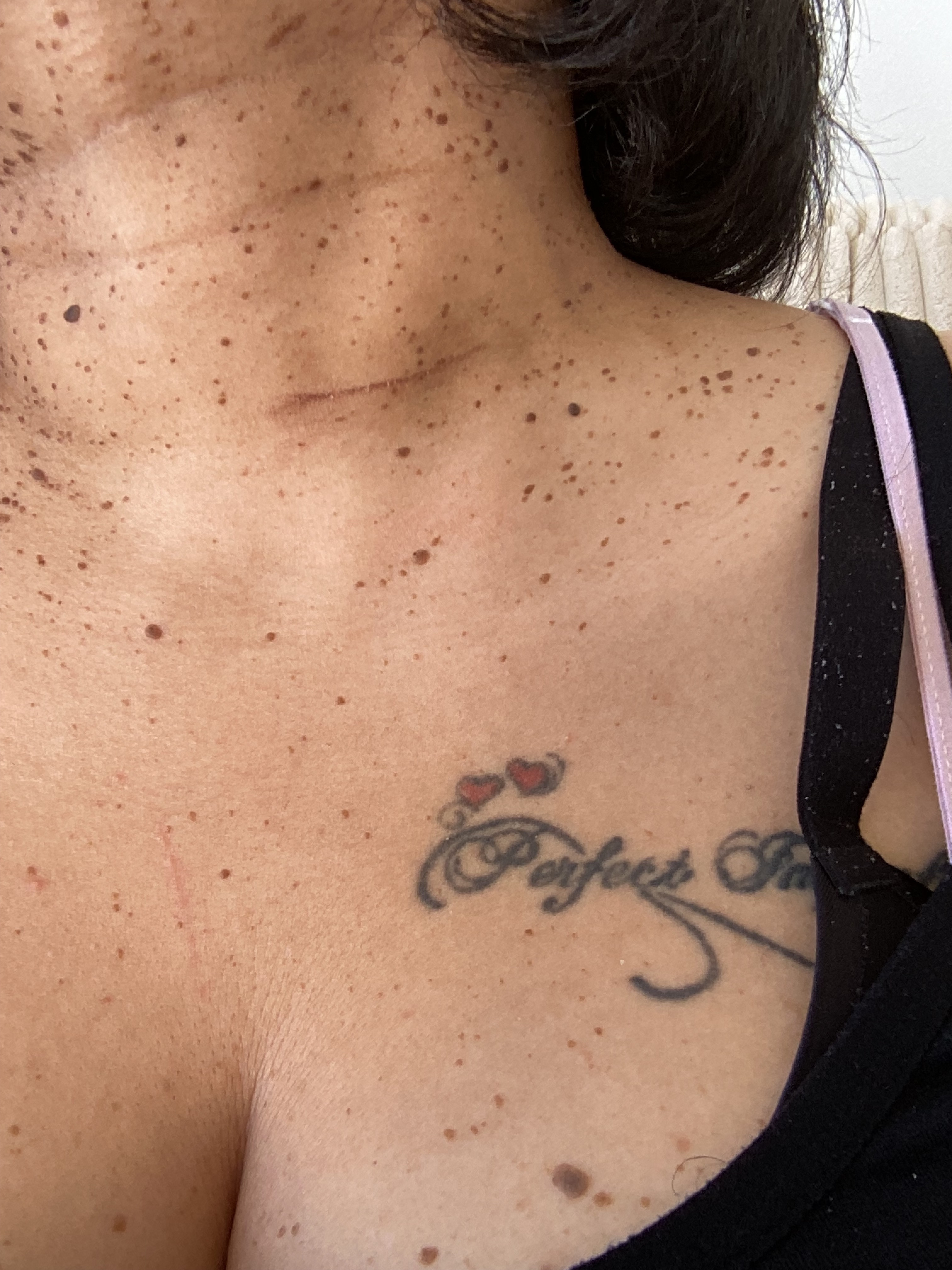 Hit-and-Run Victim in Need of Help for Recovery and Repairs campaign photo, 4 of 6