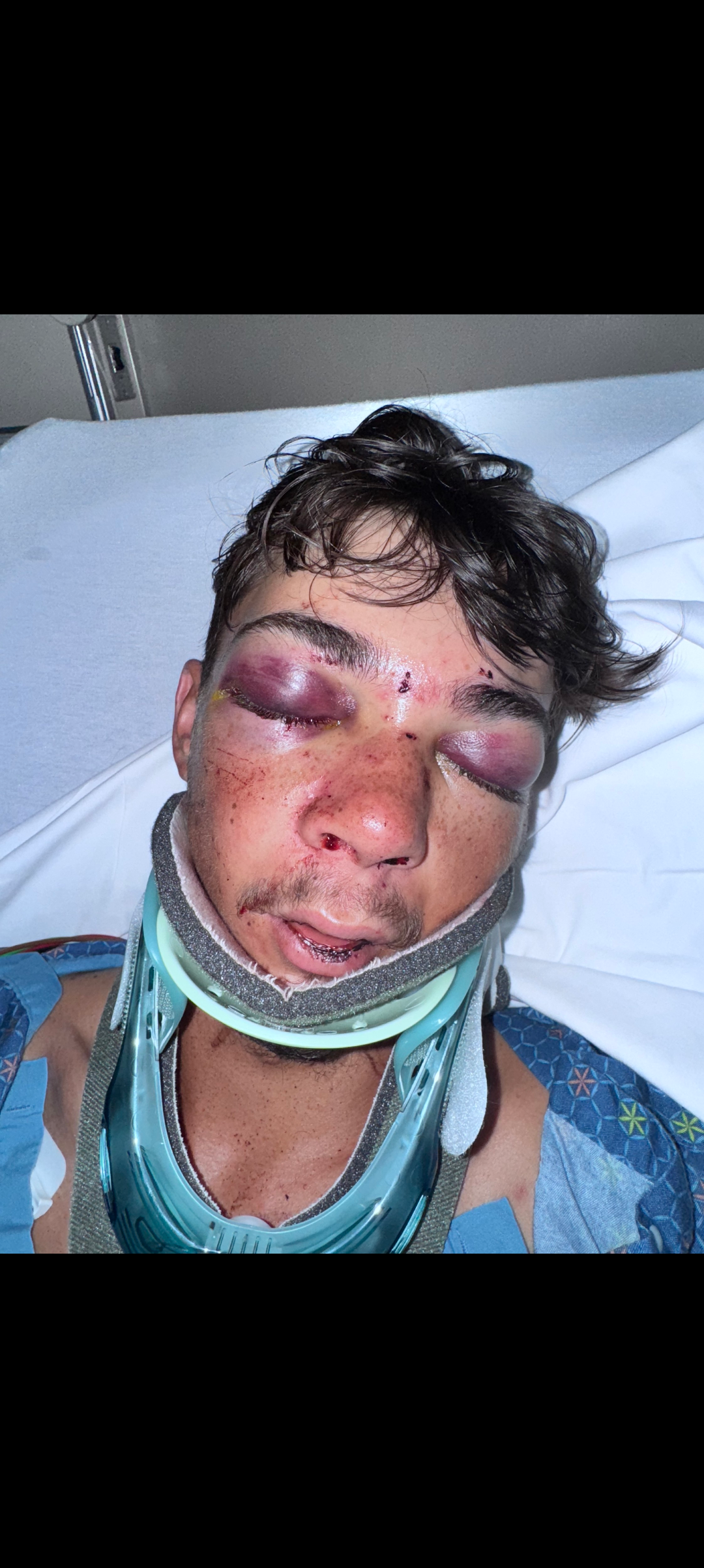 Please help Brant with his long recovery. Bless you all. campaign photo, 2 of 4