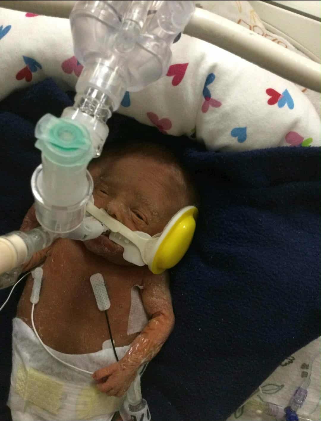 Support Marshall’s NICU Journey campaign photo, 4 of 8