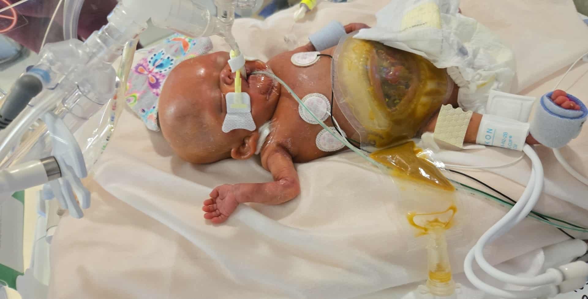 Support Marshall’s NICU Journey campaign photo, 6 of 8
