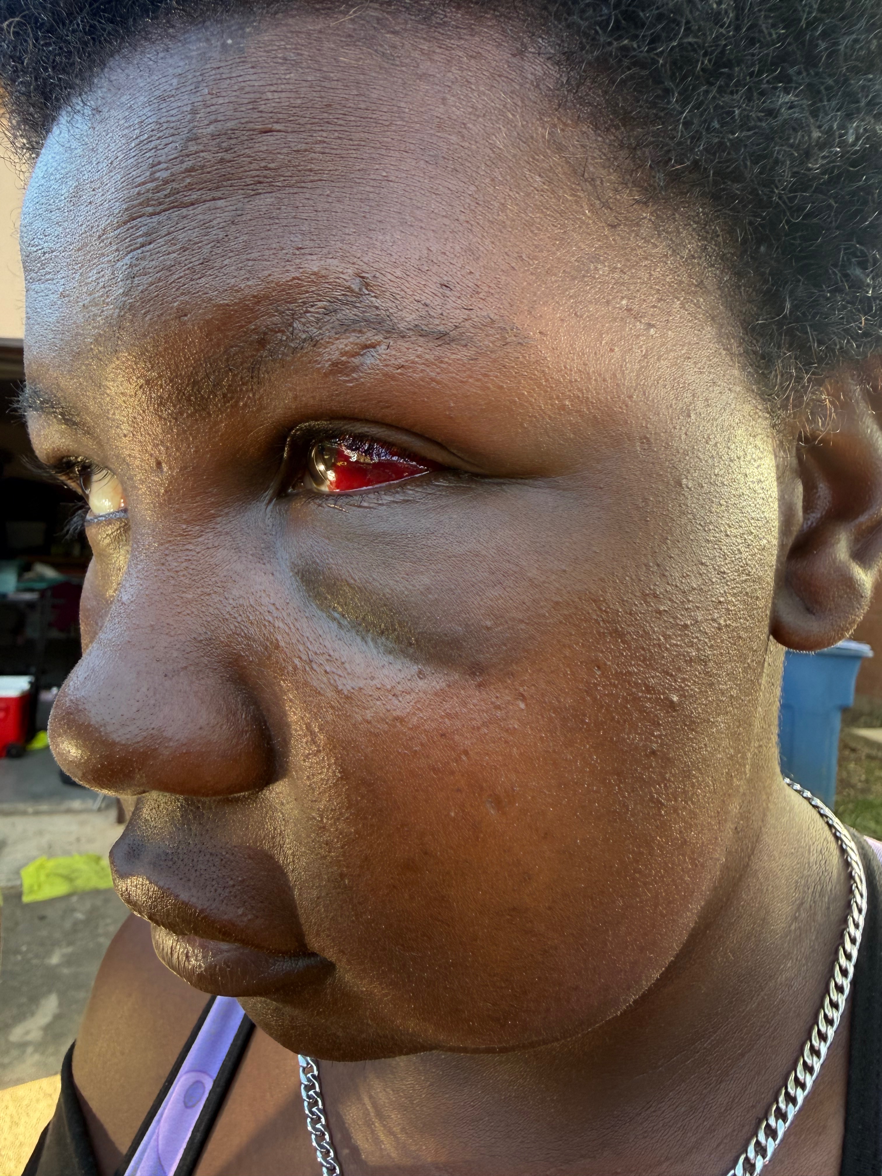 Help Christen Get Her Surgery campaign photo, 2 of 6