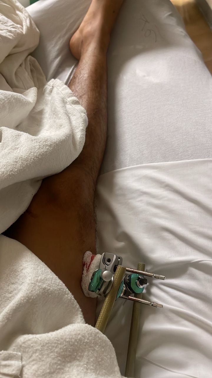 Donate to Diego's Healing Journey campaign photo, 2 of 6