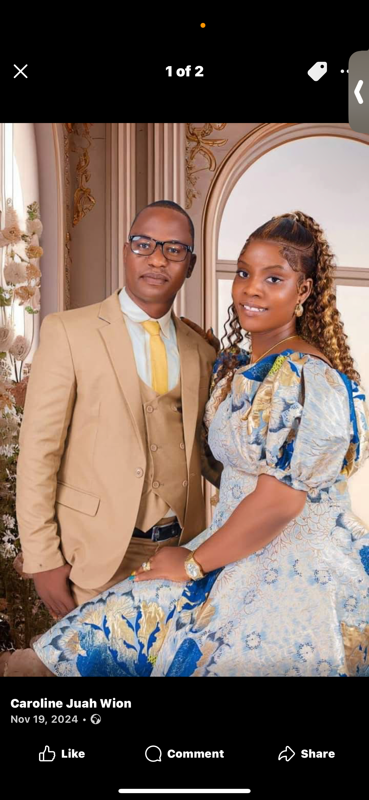 Help Josephine Heal After Burn Accident campaign photo, 4 of 6