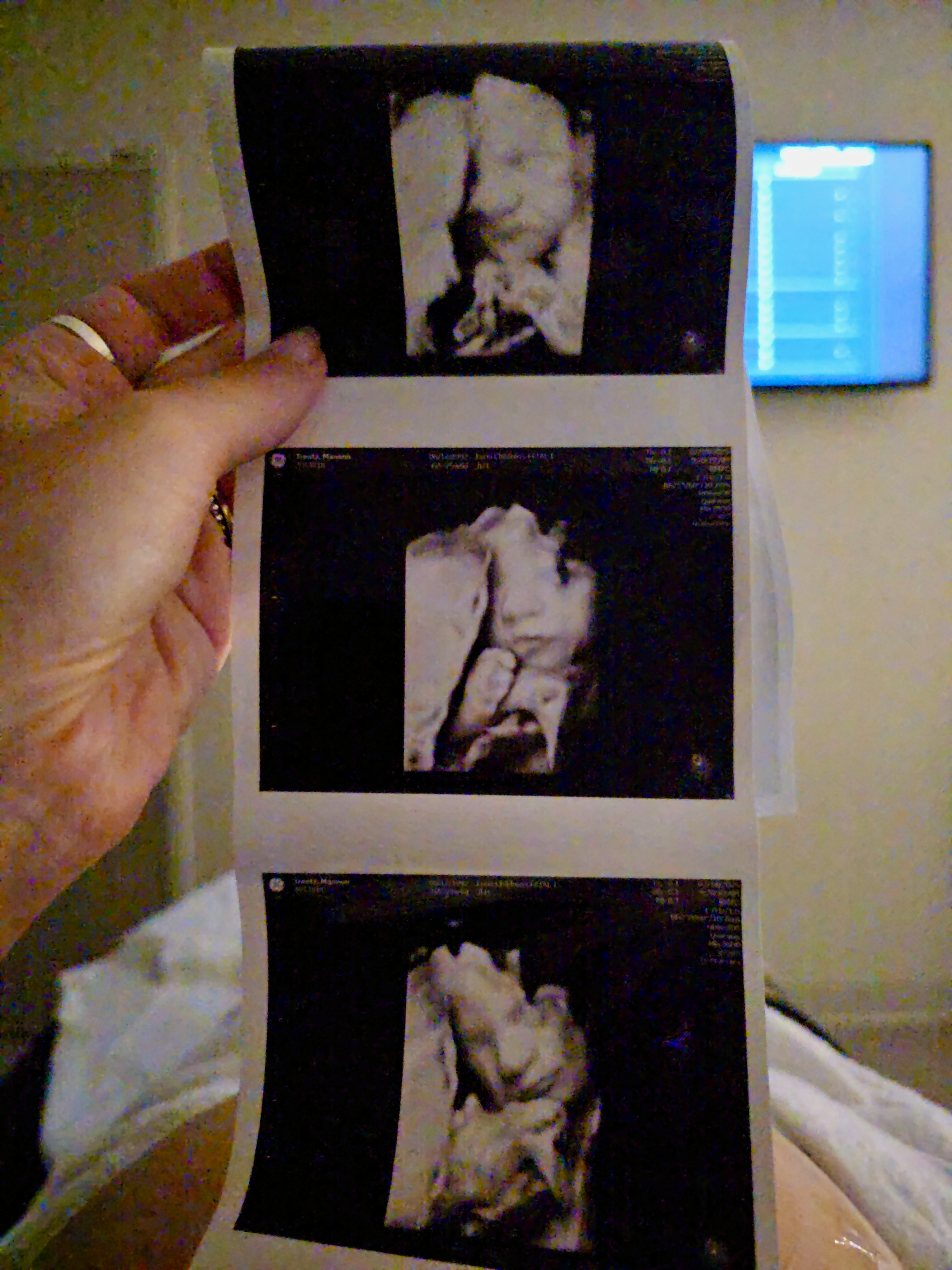 Support Baby Archie’s Heart Journey campaign photo, 7 of 8