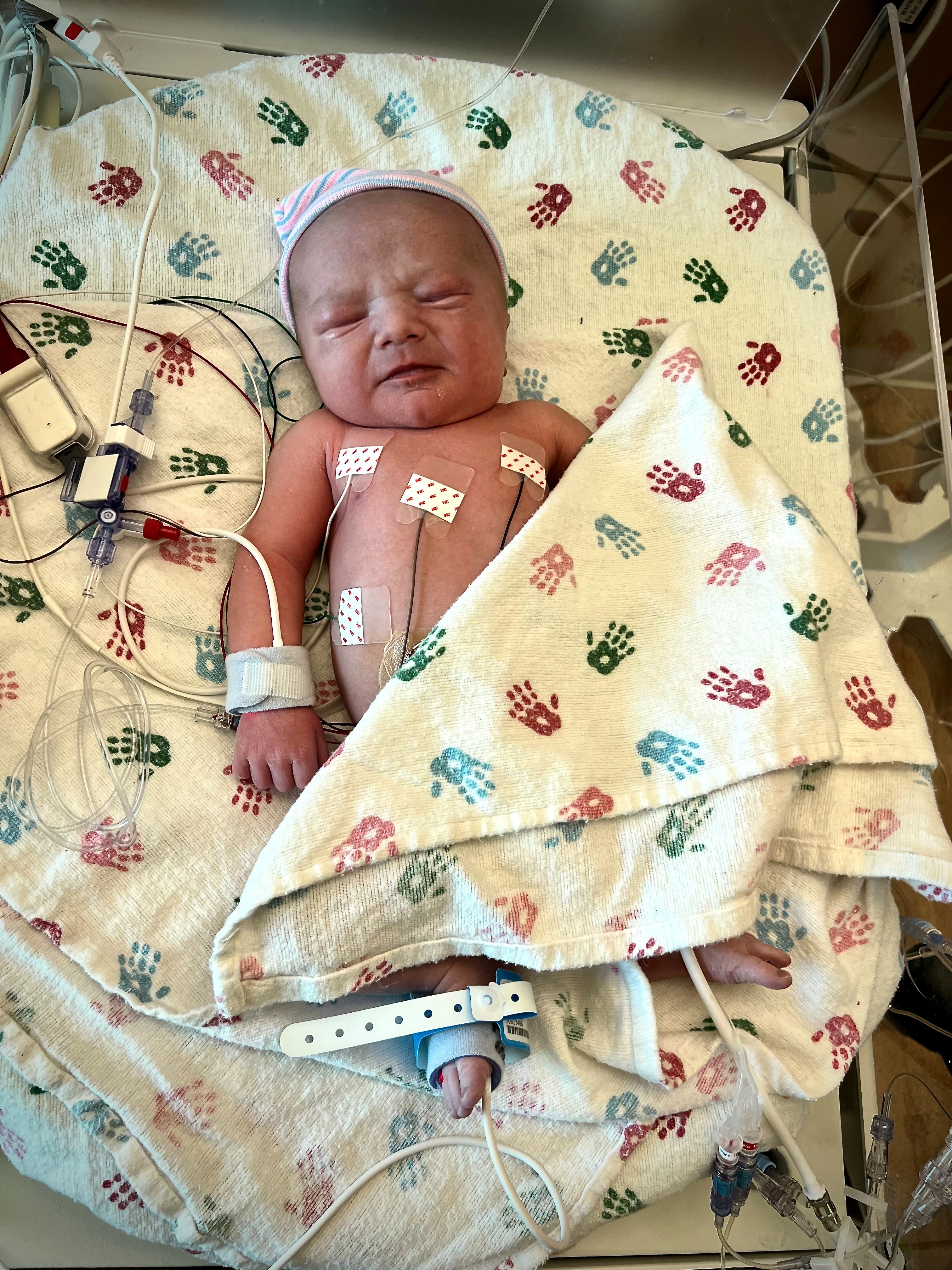 Support Baby Archie’s Heart Journey campaign photo, 6 of 8