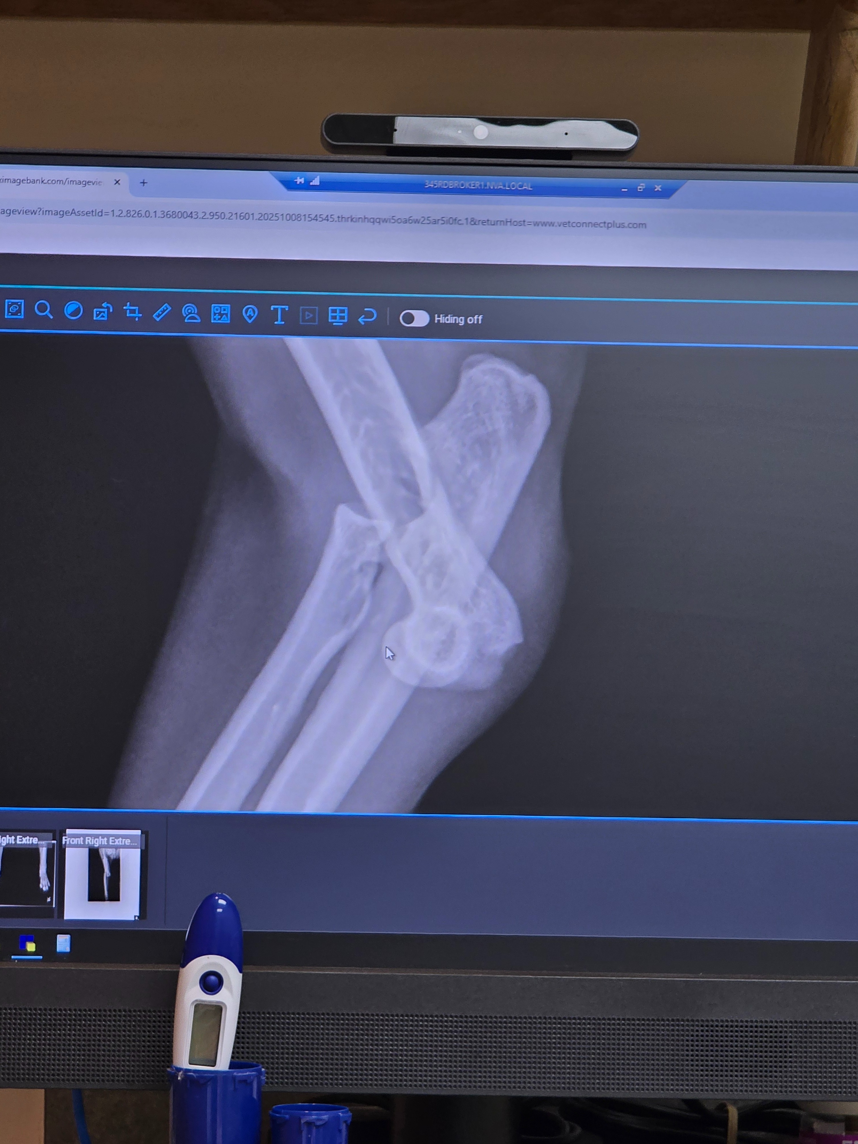 Help Salem Heal After a Traumatic Injury campaign photo, 4 of 5