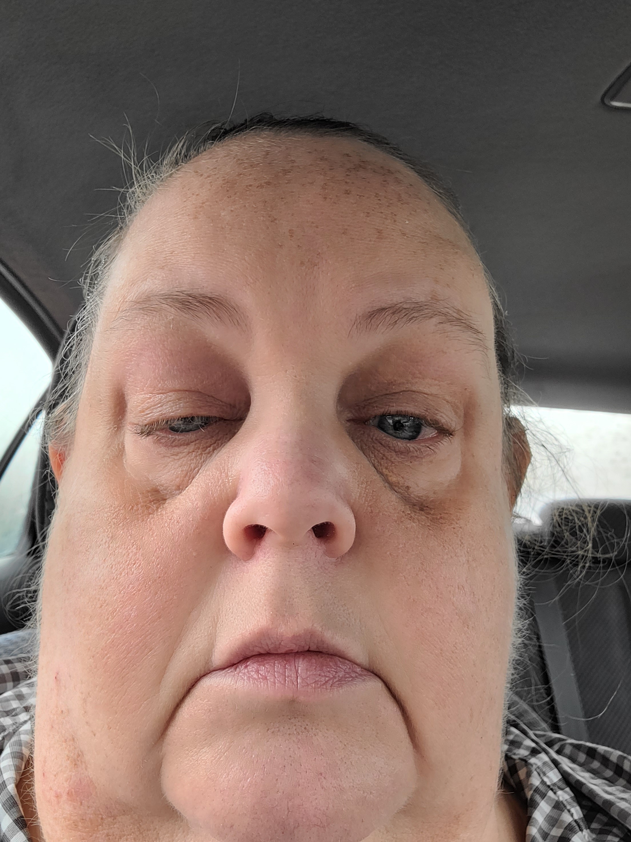 Help Maryella Heal and Find a New Feathered Friend campaign photo, 5 of 8