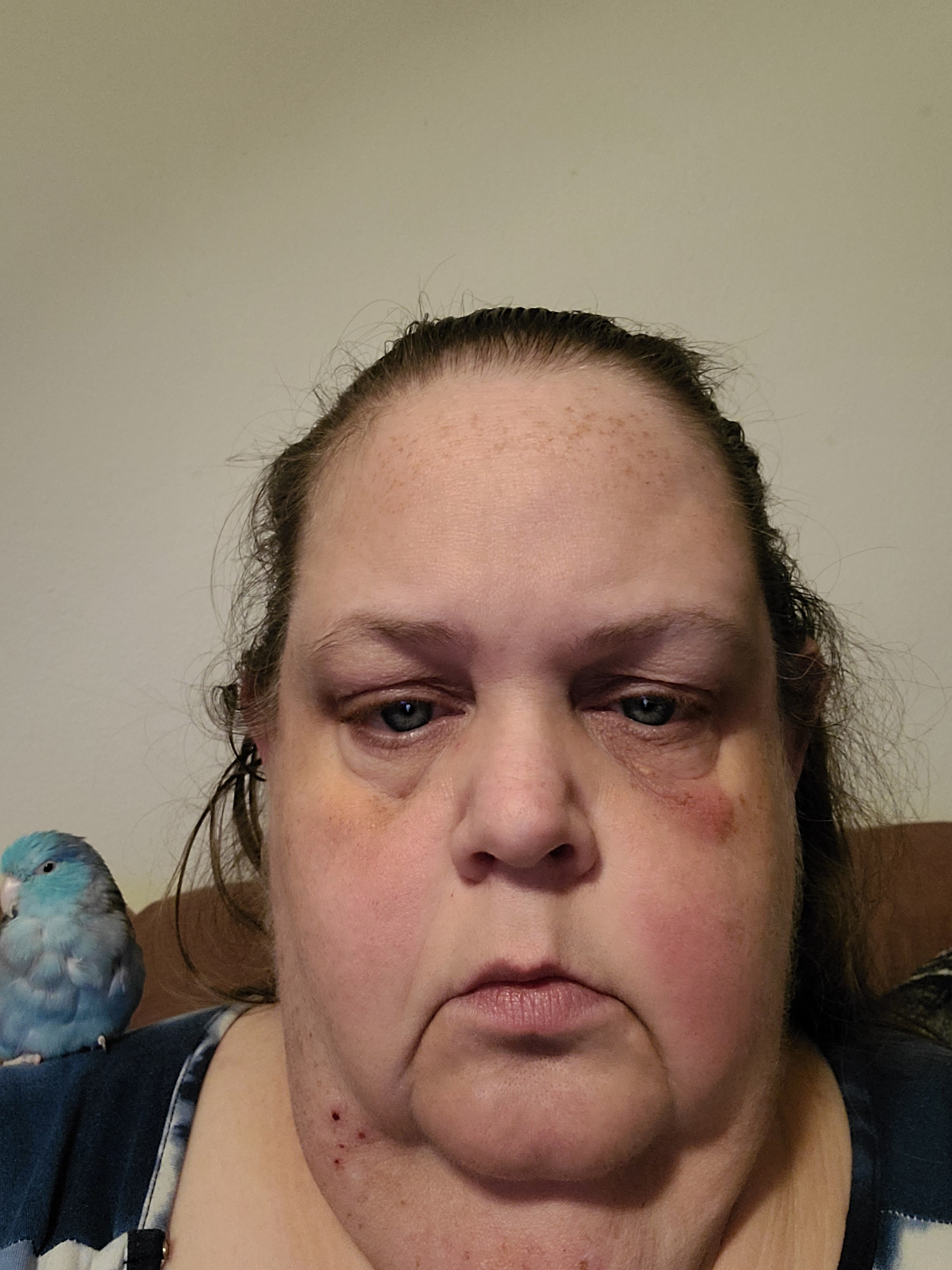 Help Maryella Heal and Find a New Feathered Friend campaign photo, 7 of 8