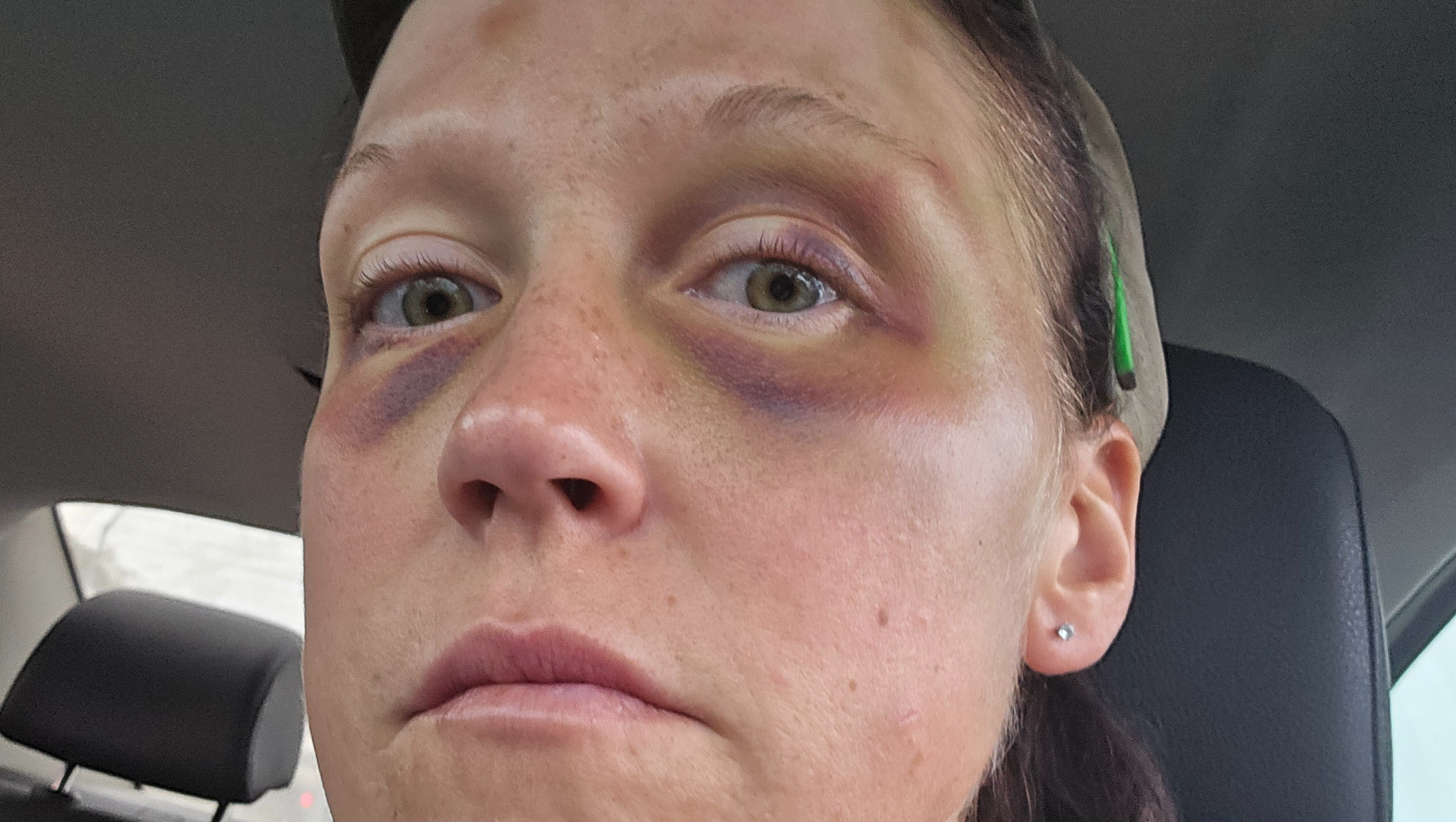 Domestic Abuse Survivor, Please help me keep my Apartment photo