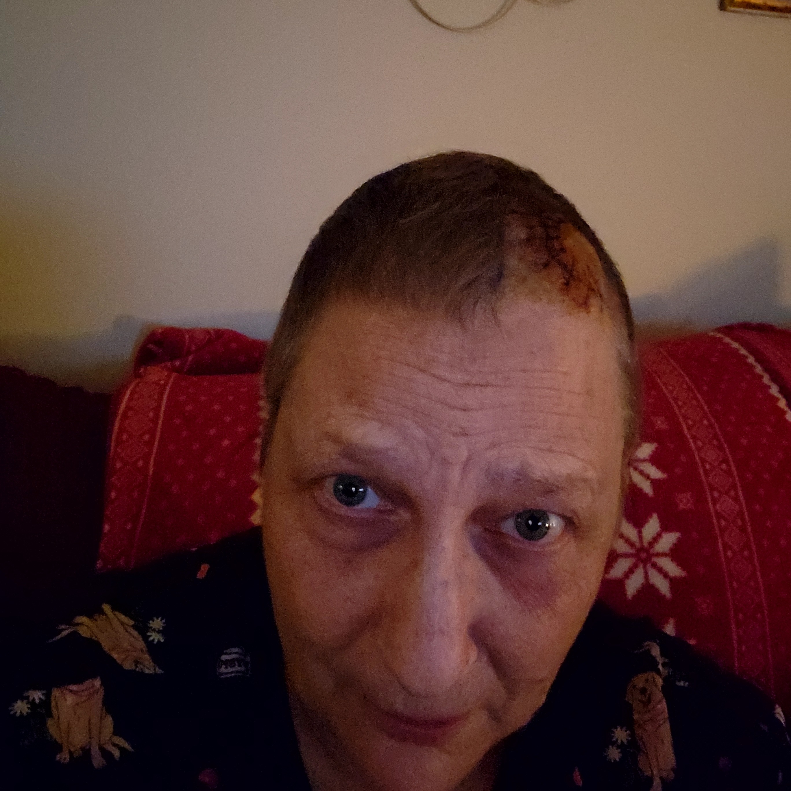 I really could use some support campaign photo, 2 of 7