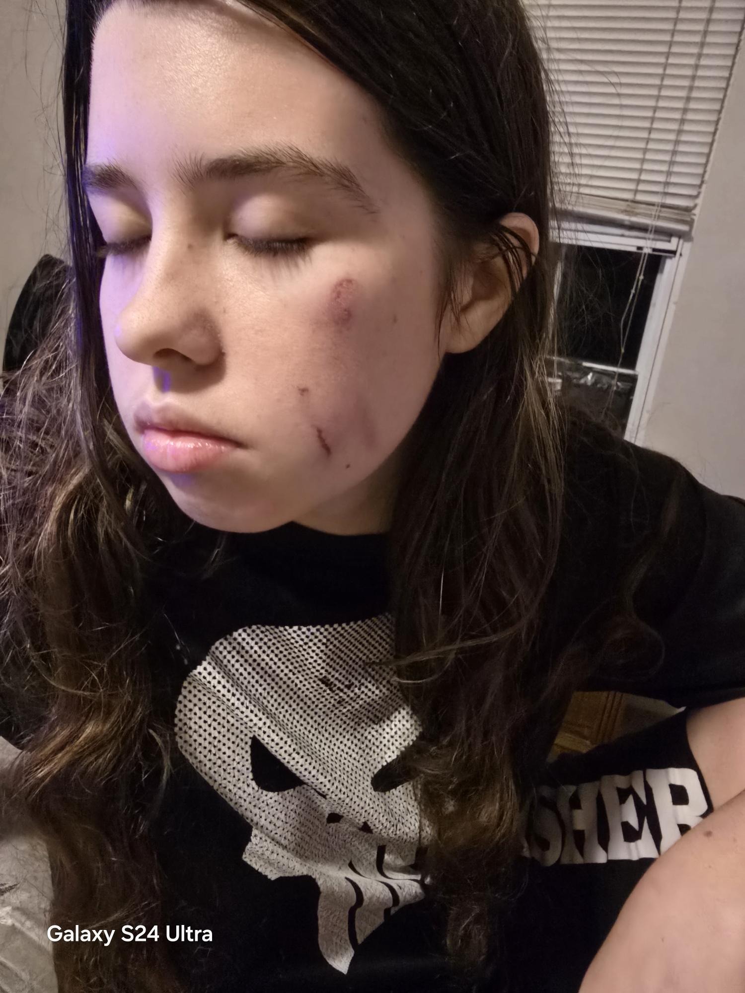 Help Erin Get a Life-Saving Service Dog campaign photo, 7 of 8
