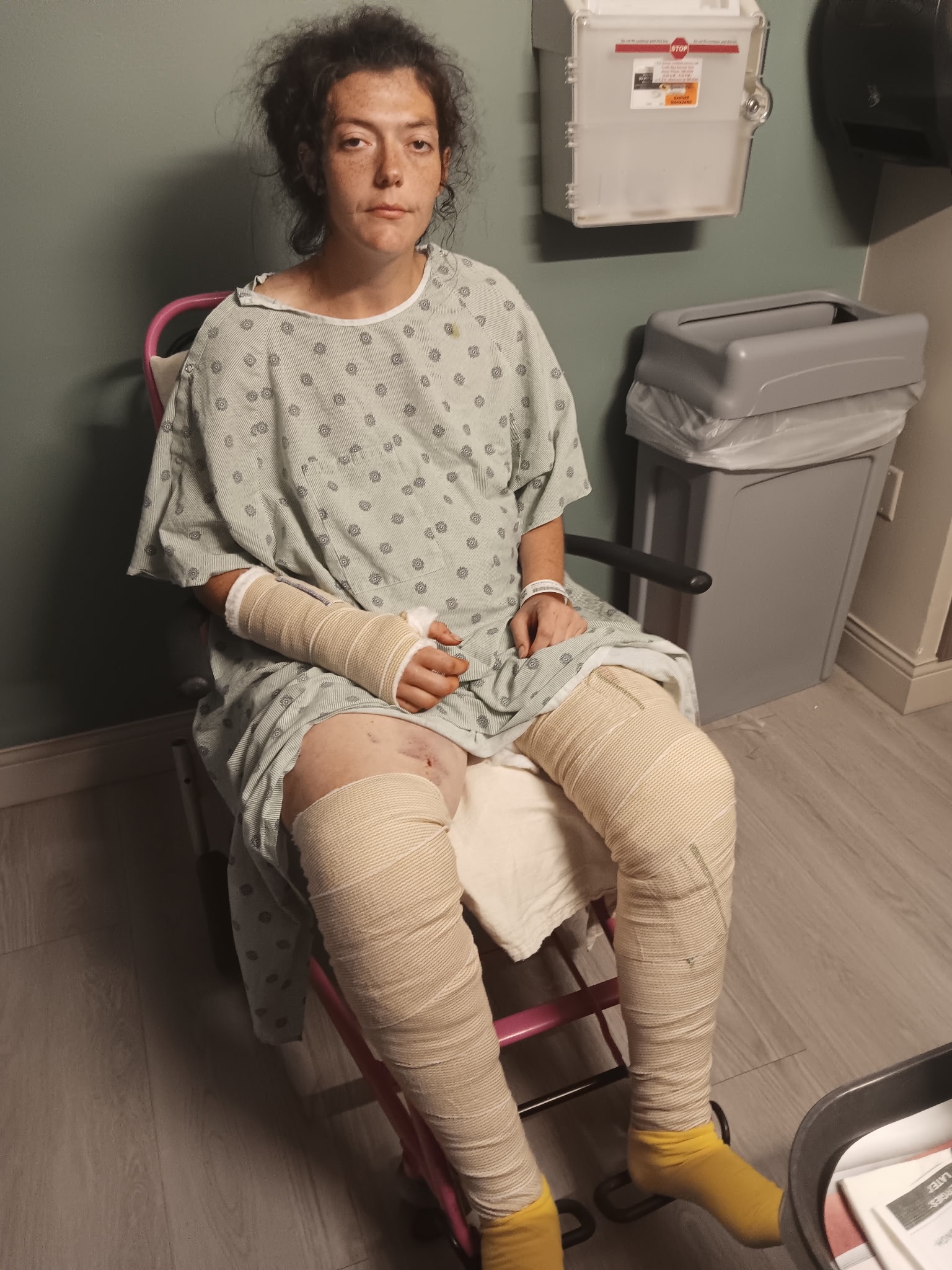Brutal XL Pit Bull attack: Help my Dad and Brook heal. campaign photo, 4 of 8