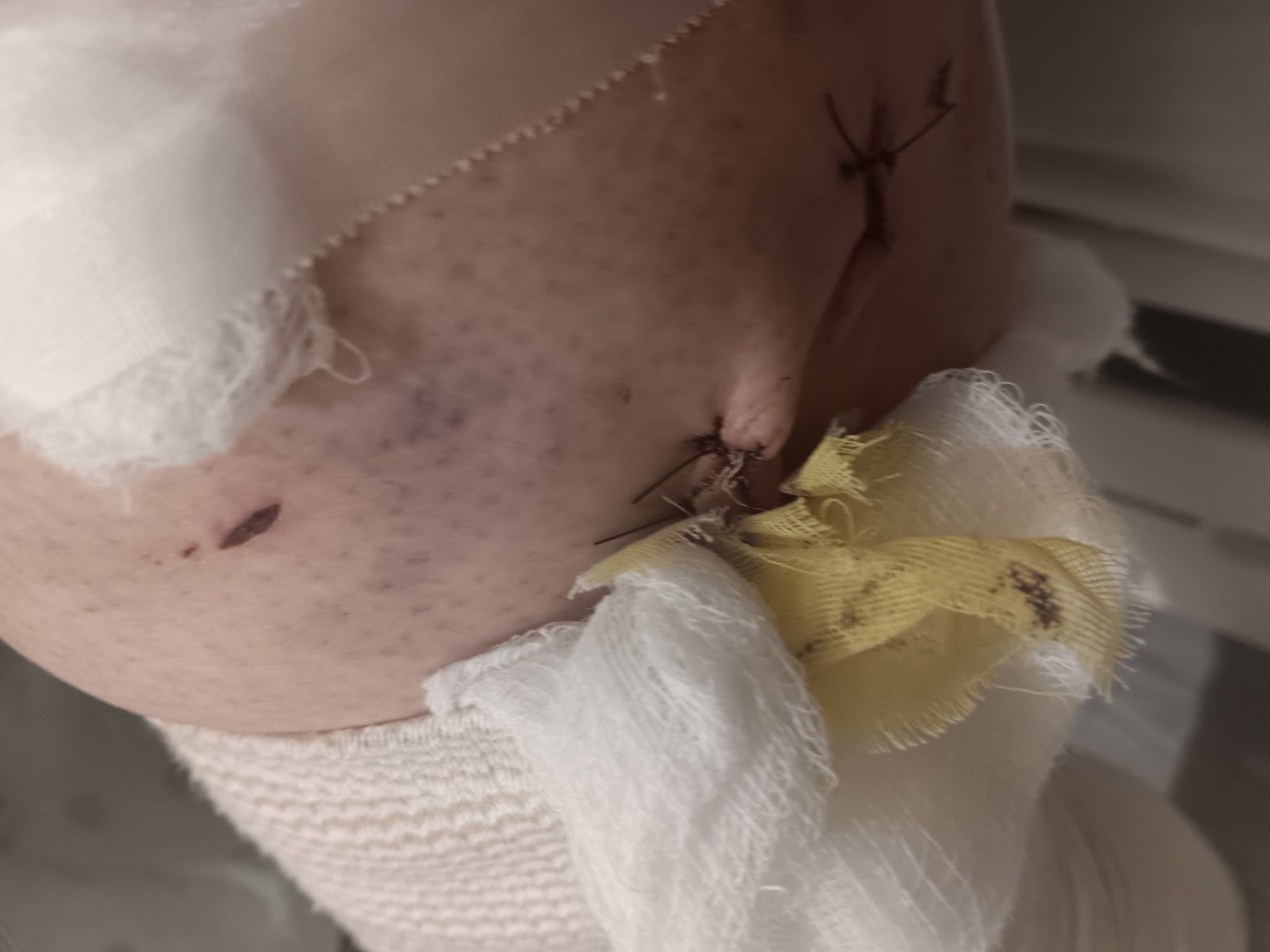 Brutal XL Pit Bull attack: Help my Dad and Brook heal. campaign photo, 5 of 8