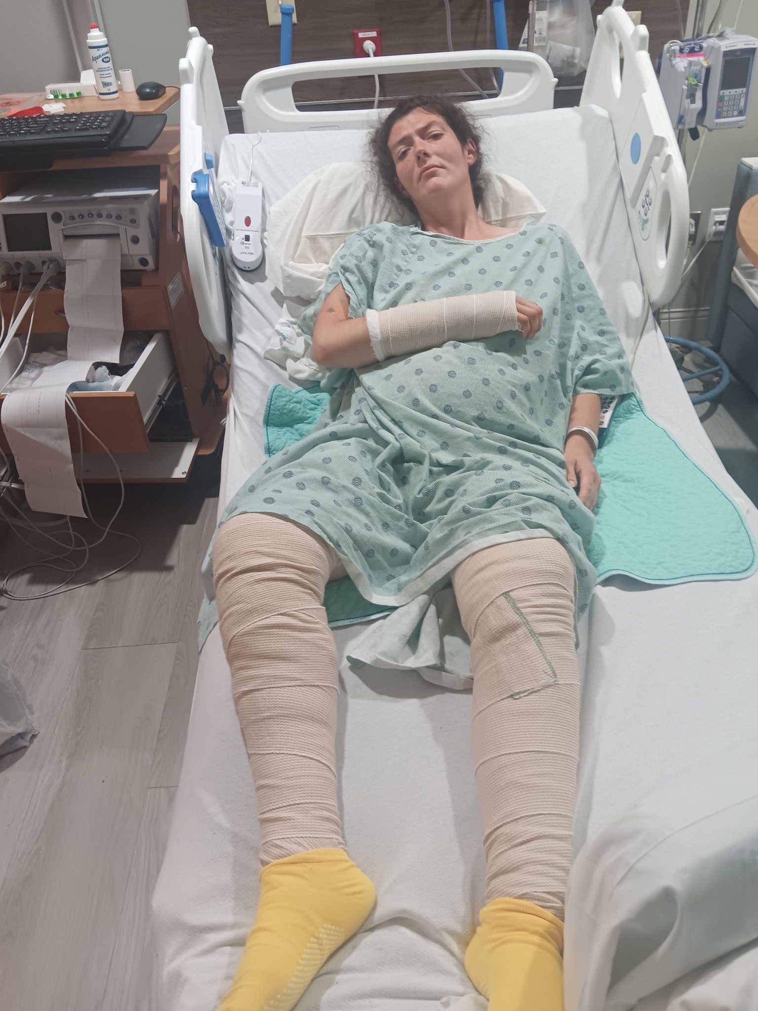 Brutal XL Pit Bull attack: Help my Dad and Brook heal. campaign photo, 6 of 8