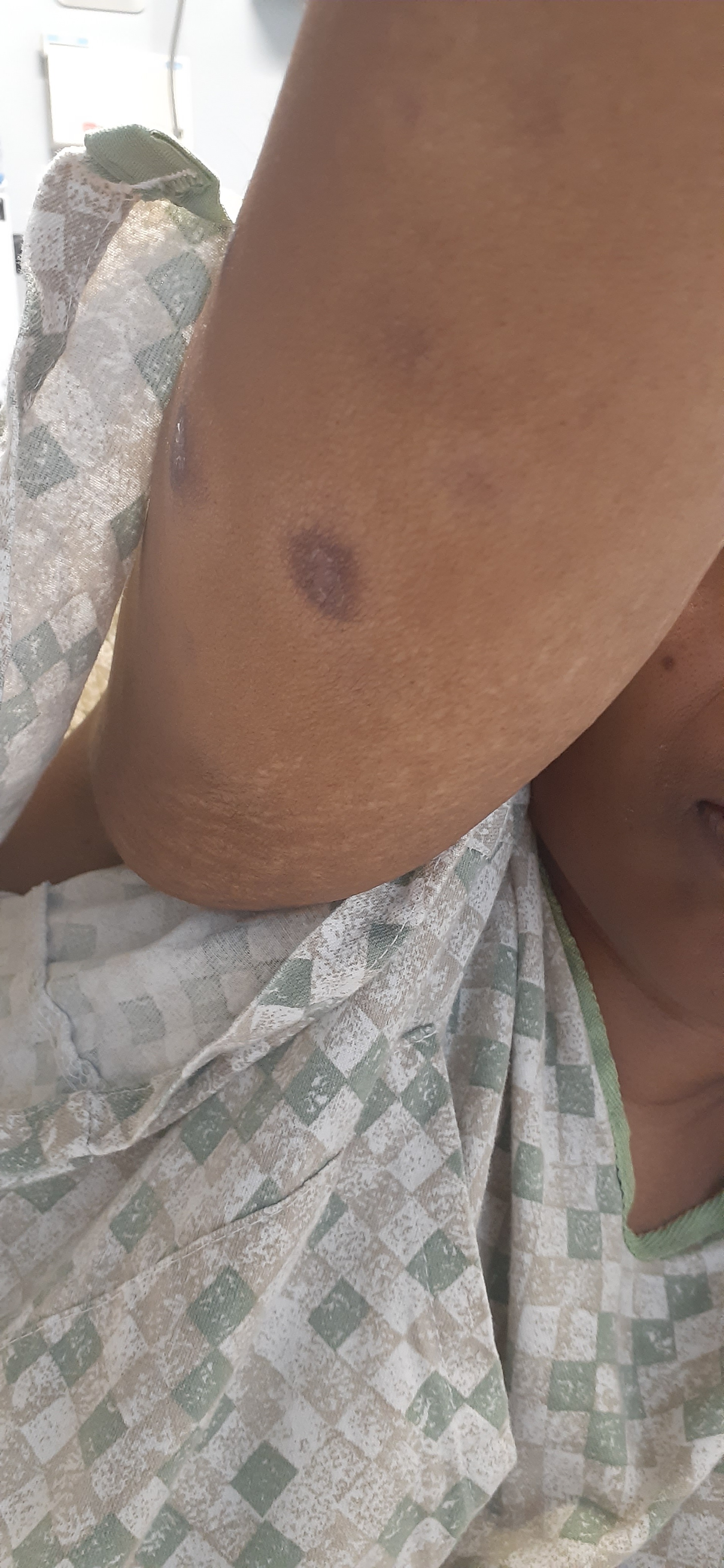 Support Roberta's Battle with Sarcoidosis campaign photo, 7 of 8