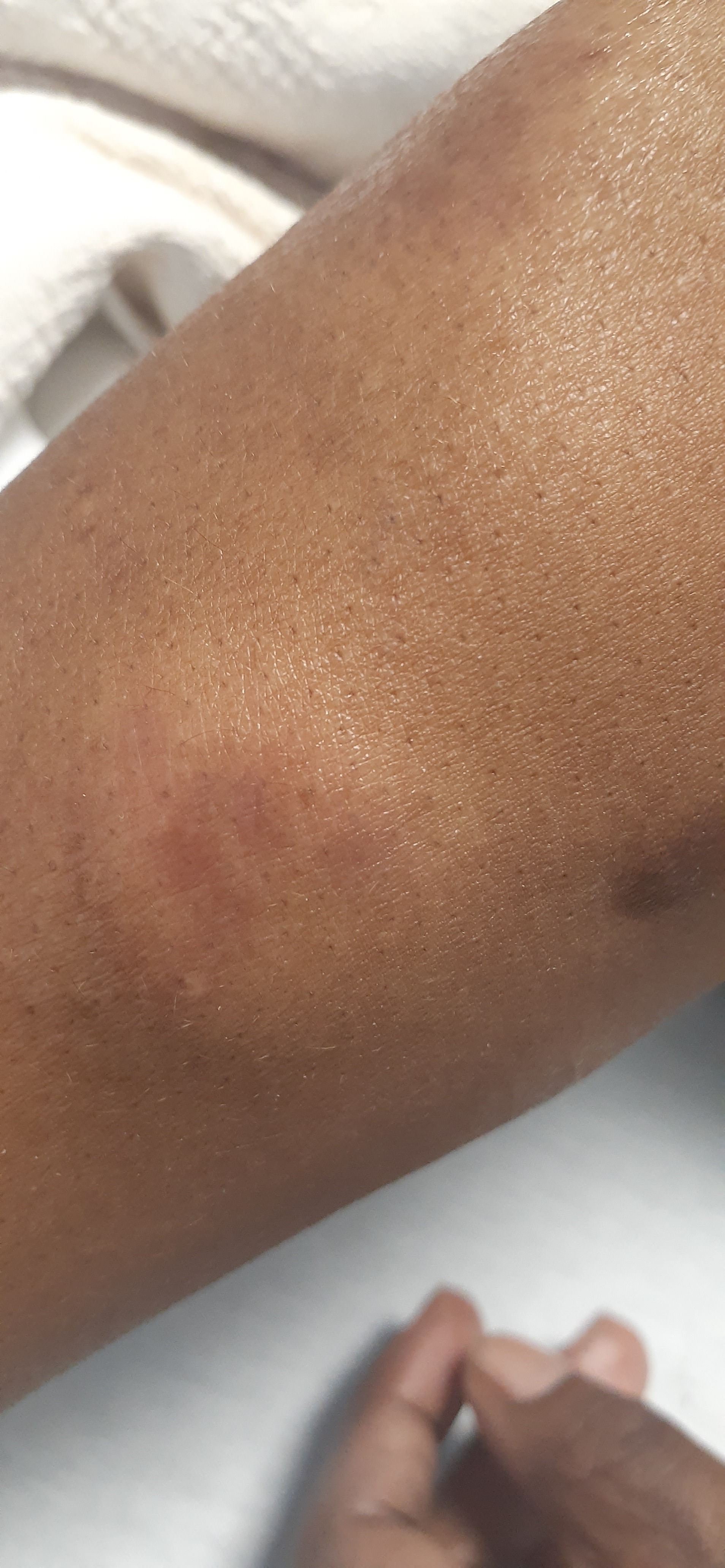 Support Roberta's Battle with Sarcoidosis campaign photo, 4 of 8