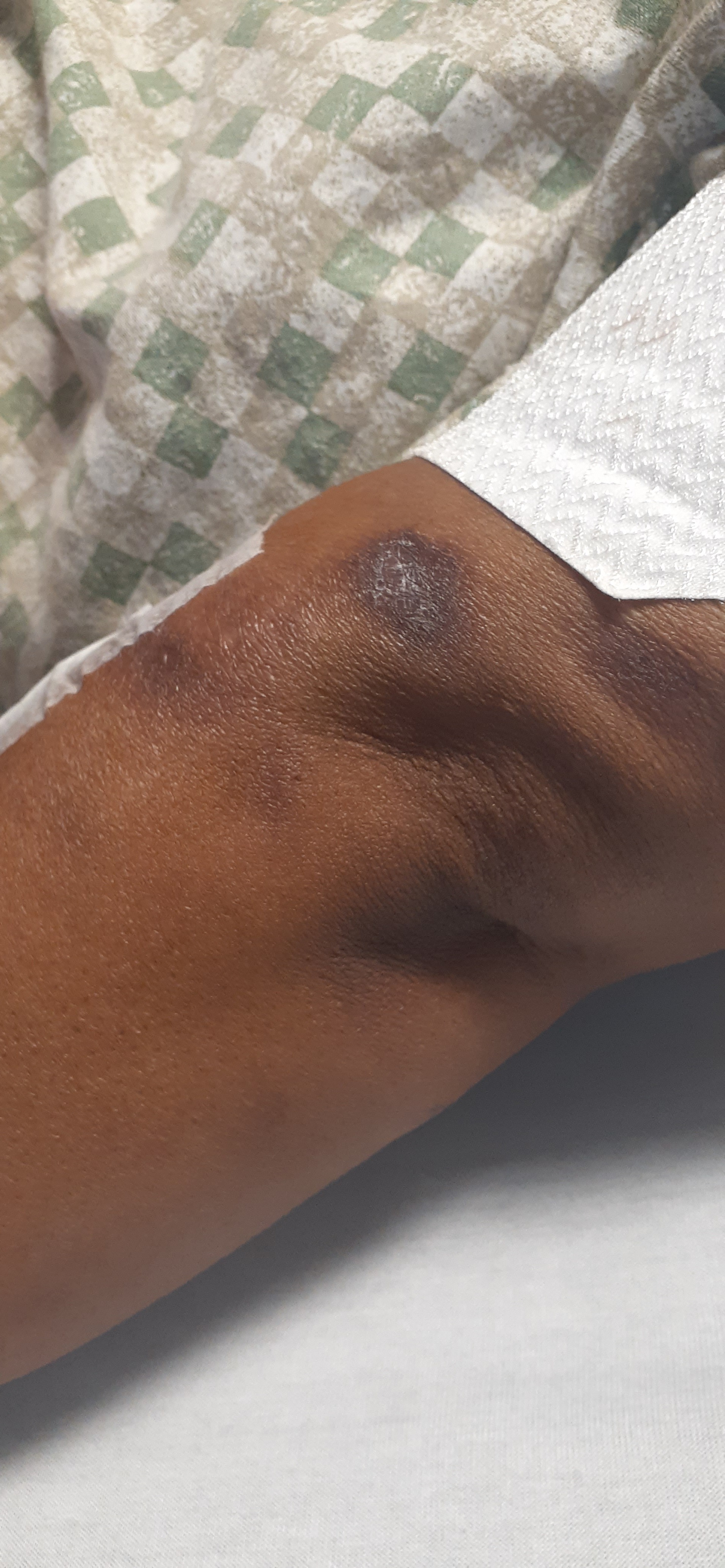 Support Roberta's Battle with Sarcoidosis campaign photo, 5 of 8